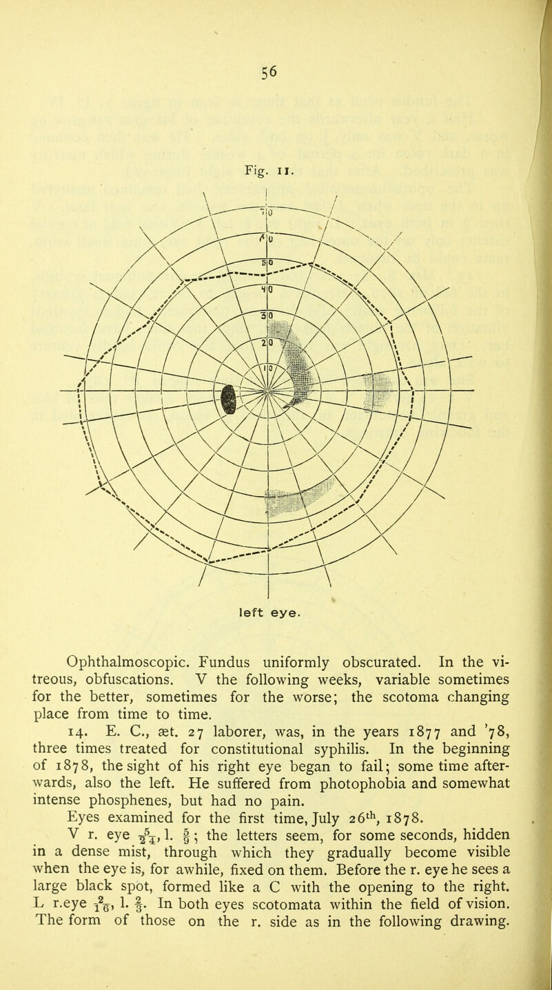 Fig. ii. left eye. Ophthalmoscopic. Fundus uniformly obscurated. In the vi- treous, obfuscations. V the following weeks, variable sometimes for the better, sometimes for the worse; the scotoma changing place from time to time. 14. E. C, set. 27 laborer, was, in the years 1877 and '78, three times treated for constitutional syphilis. In the beginning of 1878, the sight of his right eye began to fail; sometime after- wards, also the left. He suffered from photophobia and somewhat intense phosphenes, but had no pain. Eyes examined for the first time, July 26th, 1878. V r. eye ^55,1. §; the letters seem, for some seconds, hidden in a dense mist, through which they gradually become visible when the eye is, for awhile, fixed on them. Before the r. eye he sees a large black spot, formed like a C with the opening to the right. L r.eye 1. §. In both eyes scotomata within the field of vision. The form of those on the r. side as in the following drawing.