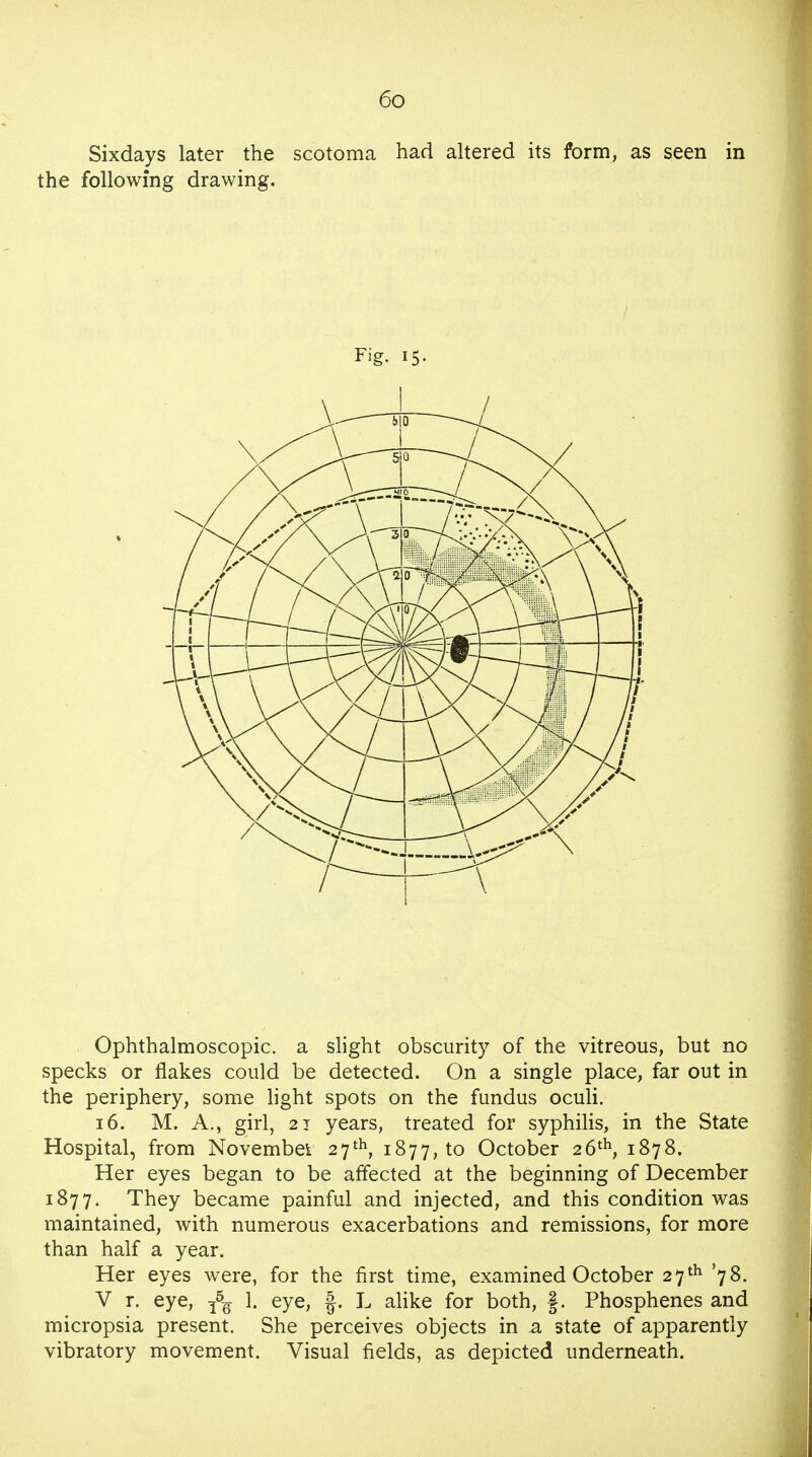 Sixdays later the scotoma had altered its form, as seen in the following drawing. Fig. 15. Ophthalmoscopic, a slight obscurity of the vitreous, but no specks or flakes could be detected. On a single place, far out in the periphery, some light spots on the fundus oculi. 16. M. A., girl, 21 years, treated for syphilis, in the State Hospital, from Novembet 27th, 1877, to October 26th, 1878. Her eyes began to be affected at the beginning of December 1877. They became painful and injected, and this condition was maintained, with numerous exacerbations and remissions, for more than half a year. Her eyes were, for the first time, examined October 27 th '78. V r. eye, ^ 1. eye, f. L alike for both, f. Phosphenes and micropsia present. She perceives objects in a state of apparently vibratory movement. Visual fields, as depicted underneath.