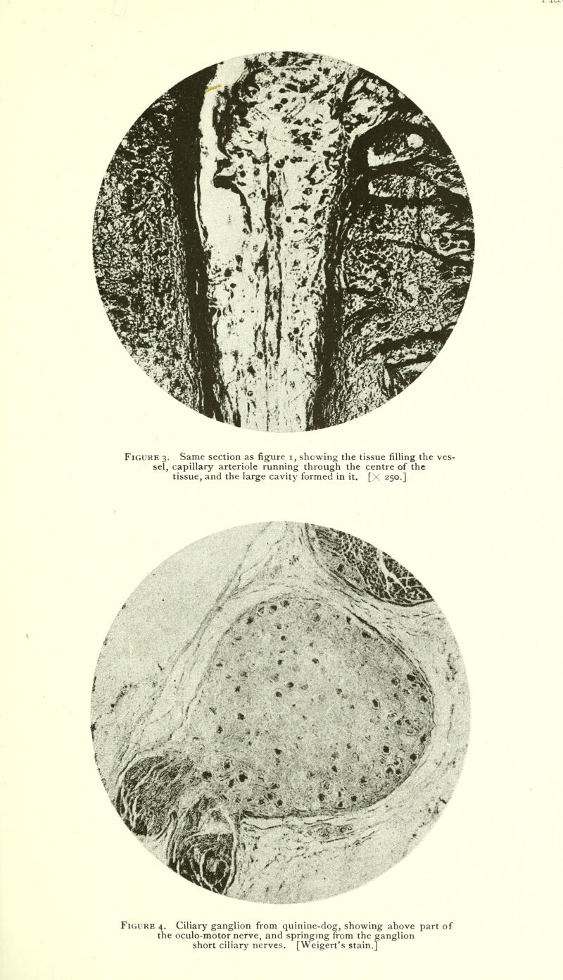 Figure 3. Same section as figure r, shewing the tissue filling the ves- sel, capillary arteriole running through the centre of the tissue, and the large cavity formed in it. [X 250.] Figure 4. Ciliary ganglion from quinine-dog, showing above part of the oculo-motor nerve, and springing from the ganglion short ciliary nerves. [Weigert's stain.]