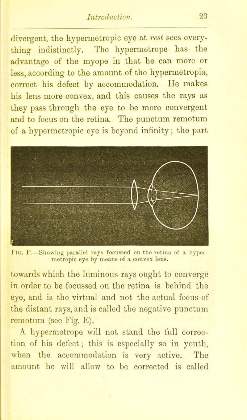 divergent, the hypermetropic eye at rest sees every- thing indistinctly. The hypermetrope has the advantage of the myope in that he can more or less, according to the amount of the hypermetropia, correct his defect by accommodation. He makes his lens more convex, and this causes the rays as they pass through the eye to be more convergent and to focus on the retina. The punctum remotum of a hypermetropic eye is beyond infinity; the part Fig. F.—Showing parallel rays focussed on the retina ot a hyper- metropic eye by means of a convex lens. towards which the luminous rays ought to converge in order to be focussed on the retina is behind the eye, and is the virtual and not the actual focus of the distant rays, and is called the negative punctum remotnm (see Fig. E). A hypermetrope will not stand the full correc- tion of his defect; this is especially so in youth, when the accommodation is very active. The amount he will allow to be corrected is called