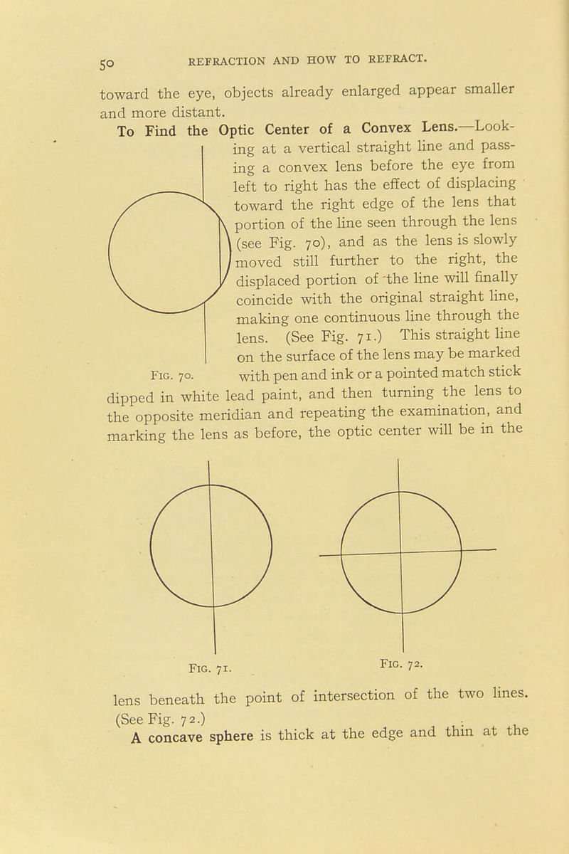 toward the eye, objects already enlarged appear smaller and more distant. To Find the Optic Center of a Convex Lens.—Look- ing at a vertical straight line and pass- ing a convex lens before the eye from left to right has the effect of displacing Otoward the right edge of the lens that portion of the line seen through the lens (see Fig. 70), and as the lens is slowly moved still further to the right, the displaced portion of 'the line will finally coincide with the original straight line, making one continuous line through the lens. (See Fig. 71.) This straight line on the surface of the lens may be marked Fig. 70. with pen and ink or a pointed match stick dipped in white lead paint, and then turning the lens to the opposite meridian and repeating the examination, and marking the lens as before, the optic center will be in the Fig. 71. Fig. 72. lens beneath the point of intersection of the two lines. (See Fig. 72.) . A concave sphere is thick at the edge and thin at the