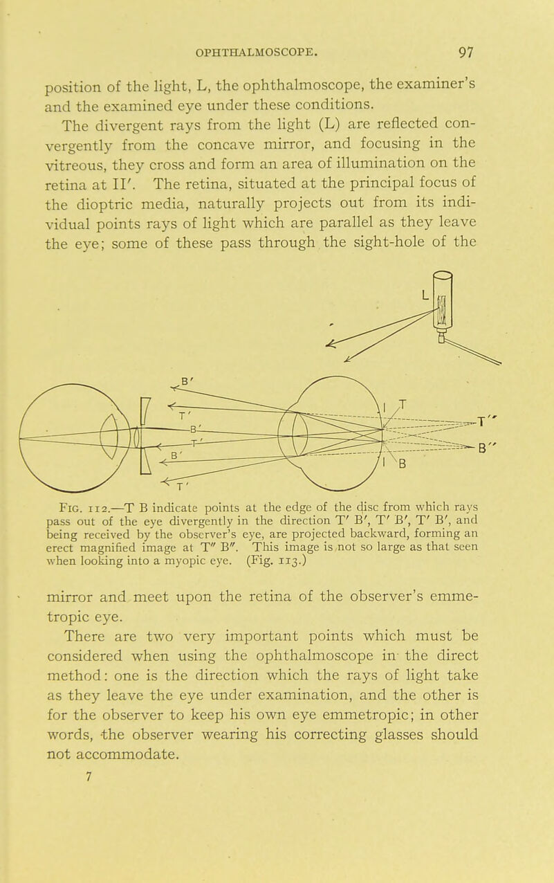 position of the light, L, the ophthalmoscope, the examiner's and the examined eye under these conditions. The divergent rays from the light (L) are reflected con- vergently from the concave mirror, and focusing in the vitreous, they cross and form an area of illumination on the retina at IF. The retina, situated at the principal focus of the dioptric media, naturally projects out from its indi- vidual points rays of light which are parallel as they leave the eye; some of these pass through the sight-hole of the Fig. ii2.—T B indicate points at the edge of the disc from which rays pass out of the eye divergently in the direction T' B', T' B', T' B', and being received by the observer's eye, are projected backward, forming an erect magnified image at T B. This image is not so large as that seen when looking into a myopic eye. (Fig. 113.) mirror and meet upon the retina of the observer's emme- tropic eye. There are two very important points which must be considered when using the ophthalmoscope in- the direct method: one is the direction which the rays of light take as they leave the eye under examination, and the other is for the observer to keep his own eye emmetropic; in other words, -the observer wearing his correcting glasses should not accommodate. 7