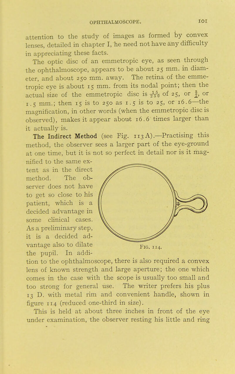 IOI attention to the study of images as formed by convex lenses, detailed in chapter I, he need not have any difficulty in appreciating these facts. The optic disc of an emmetropic eye, as seen through the ophthalmoscope, appears to be about 25 mm. in diam- eter, and about 250 mm. away. The retina of the emme- tropic eye is about 15 mm. from its nodal point; then the actual size of the emmetropic disc is ^ of 25, or J, or 1.5 mm.; then 15 is to 250 as 1.5 is to 25, or 16.6—the magnification, in other words (when the emmetropic disc is observed), makes it appear about 16.6 times larger than it actually is. The Indirect Method (see Fig. 113 A).—Practising this method, the observer sees a larger part of the eye-ground at one time, but it is not so perfect in detail nor is it mag- nified to the same ex- tent as in the direct method. The ob- server does not have to get so close to his patient, which is a decided advantage in some clinical cases. As a preliminary step, it is a decided ad- vantage also to dilate the pupil. In addi- tion to the ophthalmoscope, there is also required a convex lens of known strength and large aperture; the one which comes in the case with the scope is usually too small and too strong for general use. The writer prefers his plus 13 D. with metal rim and convenient handle, shown in figure 114 (reduced one-third in size). This is held at about three inches in front of the eye under examination, the observer resting his little and ring