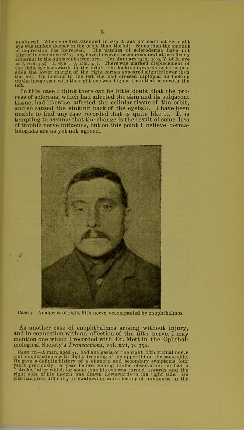 unaltered. When she first attended in 1880 it was noticed that her right eye was sunken deeper in the orbit than the left. Since then the amount or depression fcas increased. The patches of scleroderma have not altered iu size since 1889; they have, however, become somewhat less firmly adherent to the subjacent structures. On January 14th, 1899, V. of R. eye = T, Hm. 3. sf. L. eye = f. Hm. 3.5?. There was marked displacement of the right eye backwards in the orbit. On looking upwards as far as pos- sible the lower margin of the right cornea appeared slightly lower than the left On looking to the left she had crossed diplopia, on looking up the image seen with the right eye was higher than that seen with the left. In this case I think there can be little doubt that the pro- cess of sclerosis, which had affected the skin and its subjacent tissue, had likewise affected the cellular tissue of the orbit, and so caused the sinking back of the eyeball. I have been unable to find any case recorded that is quite like it. It is tempting to assume that the change is the result of some Iops of trophic nerve influence, but on this point I believe derma- tologists are as yet not agreed. Case 4.—Analgesia of right fifth nerve, accompanied by enophthalmos. As another case of enophthalmos arising without injury, and in connection with an affection of the fifth nerve, 1 may mention one which I recorded with Dr. Mott in the Ophthal- mological Society's Transactions, vol. xvi, p. 354. Case iv.—A man, aged 31, had analgesia of the right fifth cranial nerve and enophthalmos with slight drooping of the upper lid on the same side. He gave a definite history of a chancre and secondary symptoms four years previously. A year before coming under observation he had a stroke, after which tor some time his eye was turned inwards, and the right side of his mouth was drawn downwards to the right side. He also had great difficulty in swallowing, and a feeling of numbness in the