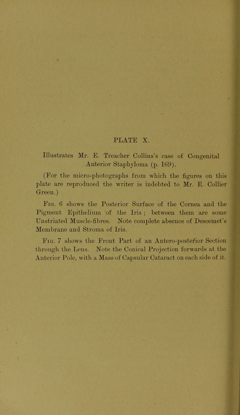 Illustrates Mr. E. Treacher Collins's case of Congeuital Anterior Staphyloma (p. 169). (For the micro-photographs from which the figures on this plate are reproduced the writer is indebted to Mr. E. Collier Green.) Fig. 6 shows the Posterior Surface of the Cornea and the Pigment Epithelium of the Iris ; between them are some Unstriated Muscle-fibres. Note complete absence of Descemet's Membrane and Stroma of Iris. Fig. 7 shows the Front Part of an Antero-postefior Section through the Lens. Note the Conical Projection forwards at the Anterior Pole, with a Mass of Capsular Cataract on each side of it.