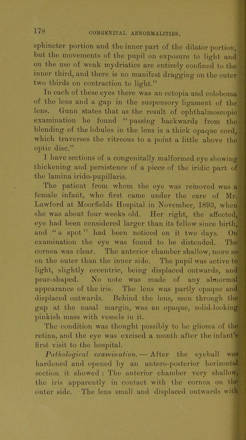 sphincter portion and tlie inner part of the dilator portion, but the movements of the pupil on exposure to ]\^]it and on tlie use of weak mydriatics are entirely confined to the inner third, and there is no manifest dragging on the outer two thirds on contraction to light. In each of these eyes there was an ectopia and coloboma of the lens and a gap in the suspensory ligament of the lens. Gunn states that as the result of ophthalmoscopic examination he found  passing backward^ from the blending of the lobules in the lens is a thick opaque cord, which traverses the vitreous to a point a little above the optic disc. I have sections of a congenitally malformed eye sliowinu- thickening and persistence of a piece of the' iridic part ot the lamina irido-pupillaris. The patient from whom the eye was rernoved was :i female infant, who first came under the cai-e of Mr. Lawford at Moorfields Hospital in November, 1893, when she was about four weeks old. Her right, the afPected, eye had been considered larger than its fellow since birth, and  a spot had been noticed on it two days. On examination the eye was found to be distended. The cornea was clear. The anterior chamber shallow, more su on the outer than the inner side. The pupil was active to light, slightly eccentric, being displaced outwards, and pear-shaped. No note was made of any abnormal appearance of the iris. The lens was partly opaque ami displaced outwards. Behind the lens, seen through tlie gap at the nasal margin, was an opaque, solid-looking pinkish mass with vessels in it. The condition was thought possibly to be glioma of the retina, and the eye was excised a month after the infantV first visit to the hospital. Pathological examination.— After the eyeball was hardened and opened by an antero-posterior horizontal section it showed ; The anterior chamber very sliallow, the ii'is apparently in contact with the cornea on the outer side. The lens small and displaced outwards with