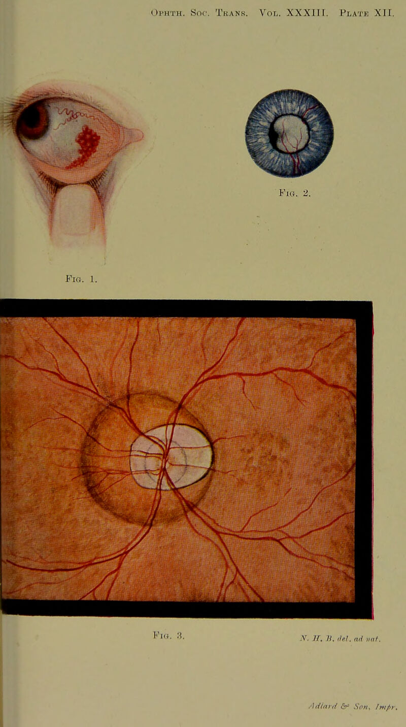Fm. 2. A Fk4. 3. iV. J/-, V. del. ad vat.