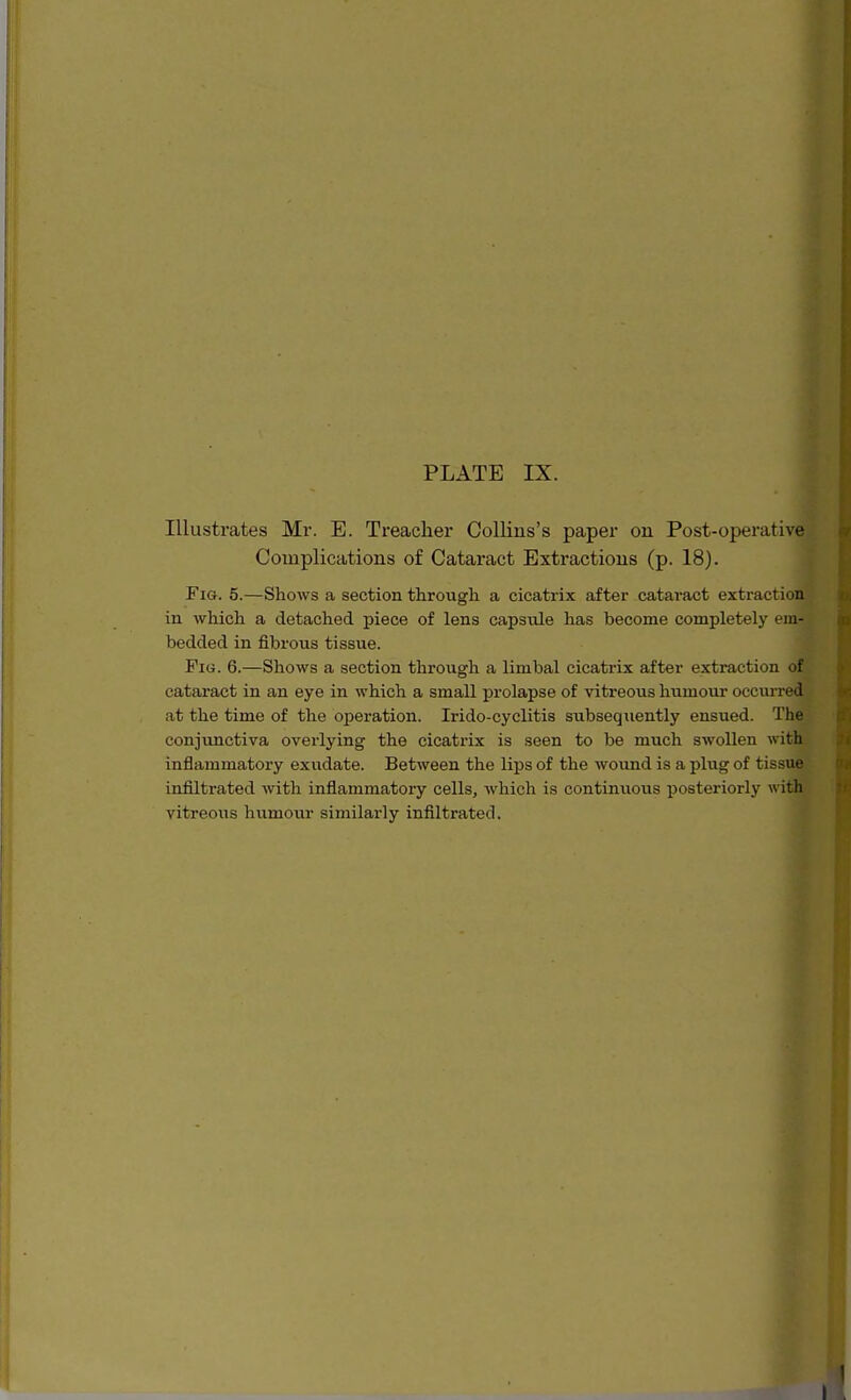 Illustrates Mr. E. Treacher Collins's paper on Post-operative Complications of Cataract Extractions (p. 18). Fig. 5.—Shows a section through a cicatrix after cataract extraction in which a detached piece of lens capsule has become completely em- bedded in fibrous tissue. Fi«. 6.—Shows a section through a limbal cicatrix after extraction of cataract in an eye in which a small prolapse of vitreous humour occurred at the time of the operation. Irido-cyclitis subseq\iently ensued. The conjunctiva overlying the cicatrix is seen to be much swollen with inflammatory exudate. Between the lips of the wound is a plug of tissue infiltrated with inflammatory cells, which is continuous posteriorly with vitreous humour similarly infiltrated.