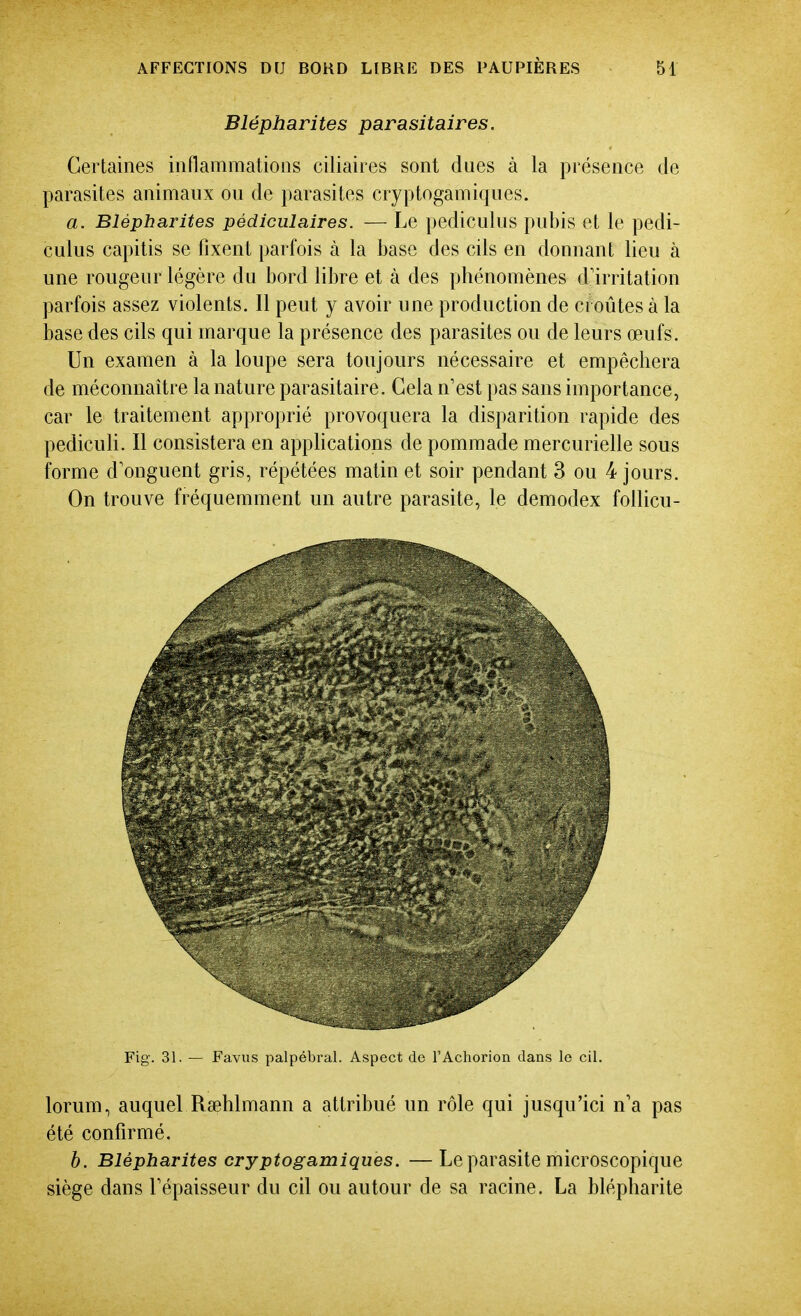 Blépharites parasitaires. Certaines inflammations ciliaires sont dues à la présence de parasites animaux ou de parasites cryptogamiques. a. Blépharites pédiculaîres. — Le pediculus pubis et le pedi- culus capitis se fixent parfois à la base des cils en donnant lieu à une rougeur légère du bord libre et à des phénomènes d'irritation parfois assez violents. Il peut y avoir une production de croûtes à la base des cils qui marque la présence des parasites ou de leurs œufs. Un examen à la loupe sera toujours nécessaire et empêchera de méconnaître la nature parasitaire. Gela n'est pas sans importance, car le traitement approprié provoquera la disparition rapide des pediculi. Il consistera en applications de pommade mercurielle sous forme d'onguent gris, répétées matin et soir pendant 3 ou 4 jours. On trouve fréquemment un autre parasite, le demodex follicu- Fig. 31. — Favus palpébral. Aspect de l'Achorion dans le cil. lorum, auquel Rœhlmann a attribué un rôle qui jusqu'ici n'a pas été confirmé. b. Blépharites cryptogamiques. —Le parasite microscopique siège dans l'épaisseur du cil ou autour de sa racine. La blépharite