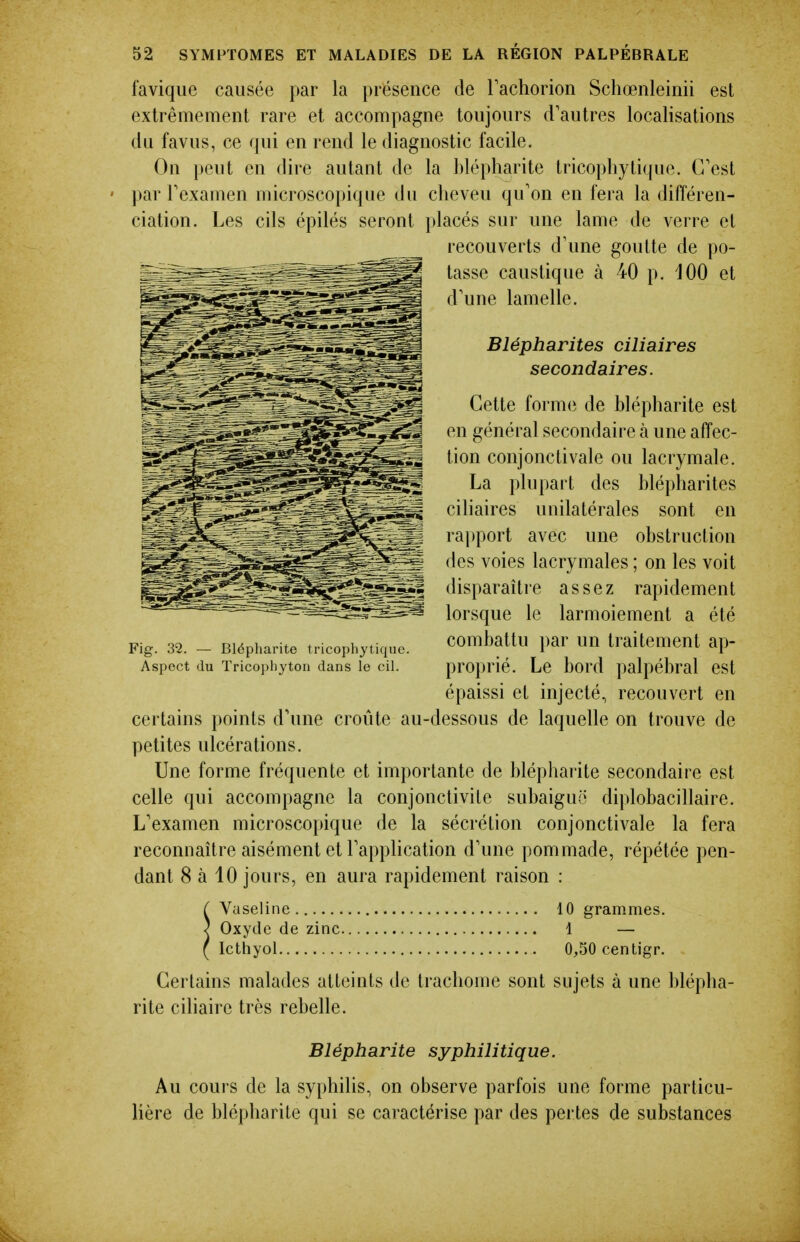 favique causée par la présence de Tachorion Schœnleiiiii est extrêmement rare et accompagne toujours d'autres localisations du favus, ce qui en rend le diagnostic facile. On peut en dire autant de la hlépharite tricophytique. C'est par Texamen microscopique du cheveu qu'on en fera la différen- ciation. Les cils épilés seront placés sur une lame de verre et recouverts d'une goutte de po- ^^^^^^^^^^^^^^^1 d'une lamelle. ^^^^^^^^^^^È^^^^M Blépharites ciliaires ^^^^^^K^^tf^^^^^^ Cette forme de hlépharite est 1^^^^^^-^^^^^^^ f^n général secondaire à une affec- ^^^^^^^^^^^^^^^^ tion conjonctivale ou lacrymale. ^^^^^^^^^^^^^^^ La plupart des hlépharites i^^.f^:^*''^^^^^^^^ ciliaires unilatérales sont en rapport avec une ohstruclion ^^^^^ff^^^^^^^^^M des voies lacrymales ; on les voit ^^^^^^^^^^^^^^^^^1 disparaître assez rapidement ~ ^^^^^^^^^^r-âê-^:^^^ lorsque le larmoiement a été Fig. 32. - Biépiiarite tricophytique. comhatlu par uu traitement ap- Aspect du Tricophyton dans le cil. proprié. Le hord palpéhral est épaissi et injecté, recouvert en certains points d'une croûte au-dessous de laquelle on trouve de petites ulcérations. Une forme fréquente et importante de hlépharite secondaire est celle qui accompagne la conjonctivite suhaiguo diplohacillaire. L'examen microscopique de la sécrétion conjonctivale la fera reconnaître aisément et l'application d'une pommade, répétée pen- dant 8 à 10 jours, en aura rapidement raison : ( Vuseline 10 grammes. ) Oxyde de zinc 1 — ( Ictliyol 0,50 centigr. Certains malades atteints de trachome sont sujets à une hlépha- rite ciliaire très rehelle. Blépharite syphilitique. Au cours de la syphilis, on ohserve parfois une forme particu- lière de blépharite qui se caractérise par des pertes de substances