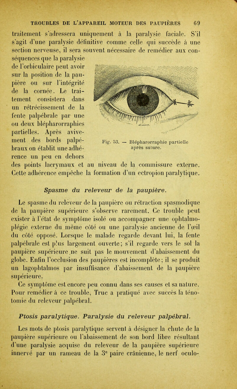 traitement s'adressera uniquement à la paralysie faciale. S'il s'agit d'une paralysie définitive comme celle qui succède à une section nerveuse, il sera souvent nécessaire de remédier aux con- séquences que la paralysie de l'orbiculaire peut avoir sur la position de la pau- pière ou sur l'intégrité de la cornée. Le trai- tement consistera dans un rétrécissement de la fente palpébrale par une ou deux blépharorraphies partielles. Après avive- ment des bords palpé- braux on établit une adhé- rence un peu en dehors des points lacrymaux et au niveau de la commissure externe. Cette adhérence empêche la formation d'un ectropion paralytique. Fig. 53. — Blépharorraphic partielle après suture. Sjpasme du releveur de la paupière. Le spasme du releveur de la paupière ou rétraction spasmodique de la paupière supérieure s'observe rarement. Ce trouble peut exister à l'état de symptôme isolé ou accompagner une ophtalmo- plégie externe du même côté ou une paralysie ancienne de l'œil du côté opposé. Lorsque le malade regarde devant lui, la fente palpébrale est plus largement ouverte ; s'il regarde vers le sol la paupière supérieure .ne suit pas le mouvement d'abaissement du globe. Enfin l'occlusion des paupières est incomplète; il se produit un lagophtalmos par insuffisance d'abaissement de la paupière supérieure. Ce symptôme est encore peu connu dans ses causes et sa nature. Pour remédier à ce trouble, Truc a pratiqué avec succès la léno- tomie du releveur palpébral. Ptosis paralytique. Paralysie du releveur palpébral. Les mots de ptosis paralytique servent à désigner la chute de la paupière supérieure ou l'abaissement de son bord libre résultant d'une paralysie acquise du releveur de la paupière supérieure innervé par un rameau de la 3^ paire crânienne, le nerf oculo-