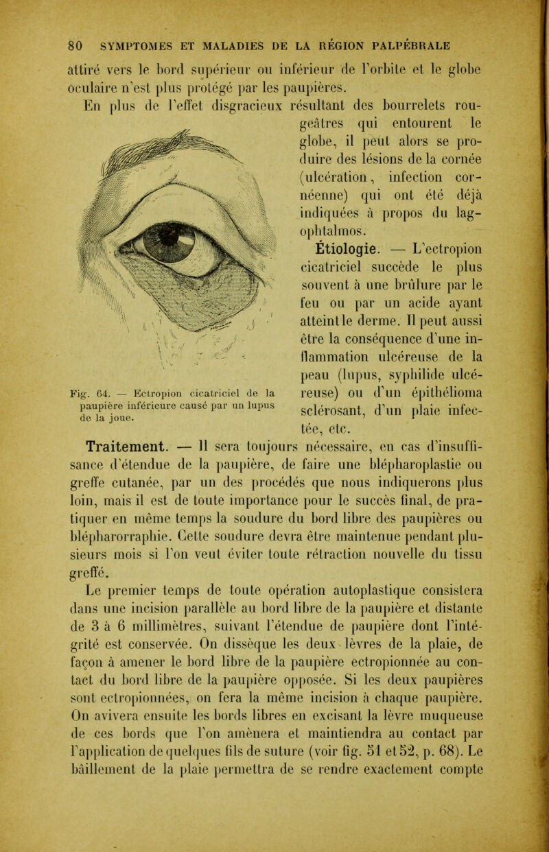 attiré vers le bord supérieur ou inférieur de Torbite et le globe oculaire n'est plus protégé par les paupières. En plus de Teffet disgracieux résultant des bourrelets rou- geâtres qui entourent le globe, il peut alors se pro- duire des lésions de la cornée (ulcération, infection cor- néenne) qui ont été déjà indiquées à propos du lag- opbtalmos. Étiologie. — L'ectropion cicatriciel succède le plus souvent à une brûlure par le feu ou par un acide ayant atteintle derme. Il peut aussi être la conséquence d'une in- flammation ulcéreuse de la peau (lupus, syphilide ulcé- reuse) ou d'un épithélioma sclérosant, d'un plaie infec- tée, etc. Traitement. — 11 sera toujours nécessaire, en cas d'insuffi- sance d'étendue de la pau})ière, de faire une blépharoplastie ou greffe cutanée, par un des procédés que nous indiquerons plus loin, mais il est de toute importance pour le succès final, de pra- tiquer en même temps la soudure du bord libre des paupières ou blépharorrapbie. Celte soudure devra être maintenue pendant plu- sieurs mois si l'on veut éviter toute rétraction nouvelle du tissu greffé. Le premier temps de toute opération autoplastique consistera dans une incision parallèle au bord libre de la paupière et distante de 3 à 6 millimètres, suivant l'étendue de paupière dont l'inté- grité est conservée. On dissèque les deux lèvres de la plaie, de façon à amener le bord libre de la paupière ectro])ionnée au con- tact du bord libre de la paupière opposée. Si les deux paupières sont ectropionnées, on fera la même incision à chaque paupière. On avivera ensuite les bords libres en excisant la lèvre muqueuse de ces bords que l'on amènera et maintiendra au contact par l'application de quelques fils de suture (voir fig. 51 et5i2, p. 68). Le bâillement de la plaie permettra de se rendre exactement compte Fig. 64. — Ectropion cicatriciel de la paupière inférieure causé par un lupus de la joue.