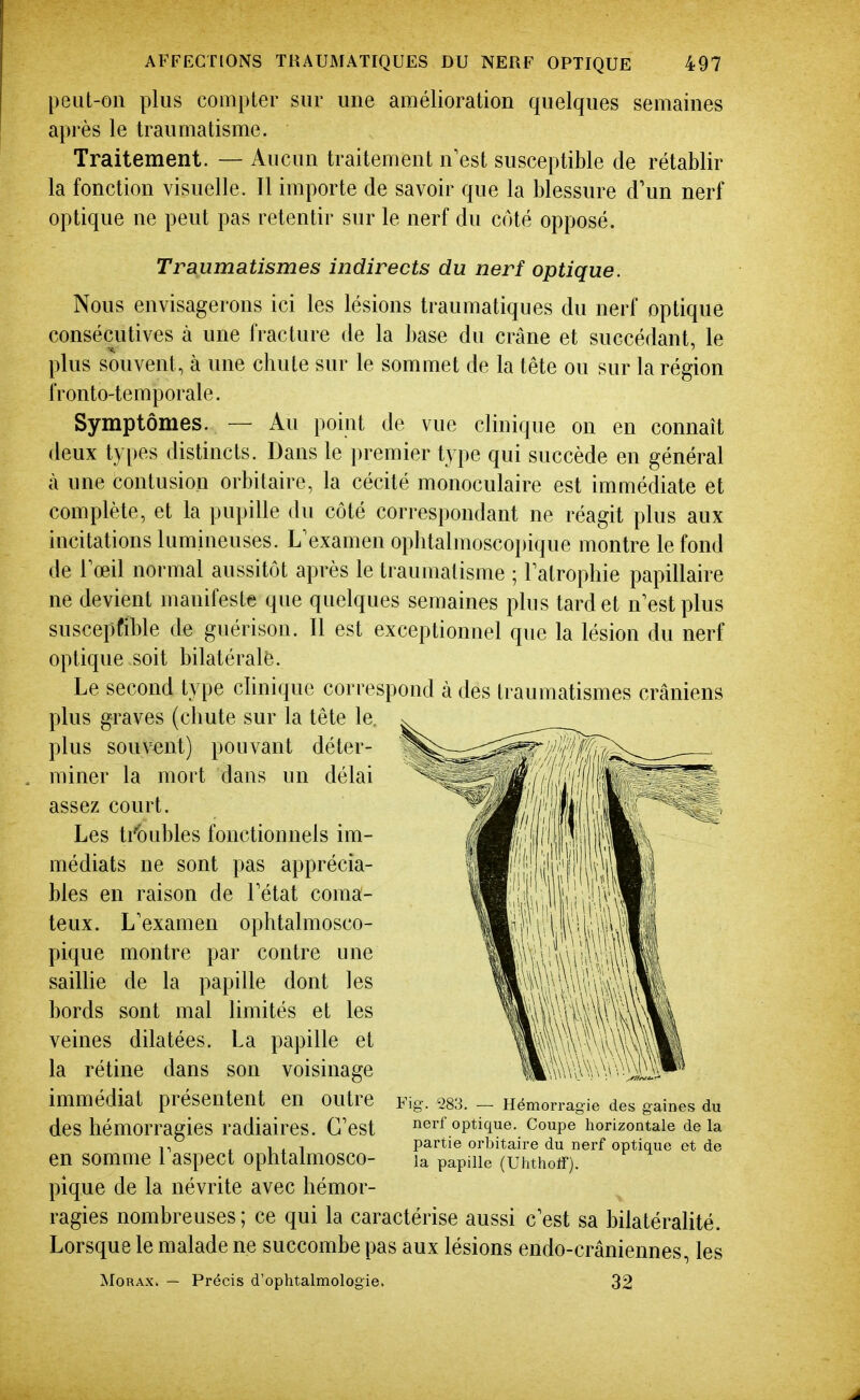 peut-on plus compter sur une amélioration quelques semaines après le traumatisme. Traitement. — Aucun traitement n'est susceptible de rétablir la fonction visuelle. Il importe de savoir que la blessure d'un nerf optique ne peut pas retentir sur le nerf du côté opposé. Traumatismes indirects du nerf optique. Nous envisagerons ici les lésions traumatiques du nerf optique consécutives à une fracture de la base du crâne et succédant, le plus souvent, à une chute sur le sommet de la tête ou sur la région iVonto-temporale. Symptômes. — Au point de vue clinique on en connaît deux types distincts. Dans le premier type qui succède en général à une contusion orbitaire, la cécité monoculaire est immédiate et complète, et la pupille du côté correspondant ne réagit plus aux incitations lumineuses. L'examen oplitalmoscopique montre le fond de Tœil normal aussitôt après le traumatisme ; latropbie papillaire ne devient manifeste que quelques semaines plus tard et n'est plus suscepfible de guérison. Il est exceptionnel que la lésion du nerf optique soit bilatéralè. Le second type clinique correspond à des traumatismes crâniens plus graves (chute sur la tête le. plus souvent) pouvant déter- miner la mort dans un délai assez court. Les ti'bubles fonctionnels im- médiats ne sont pas apprécia- bles en raison de Tétat coma- teux. L'examen ophtalmosco- pique montre par contre une sailUe de la papille dont les bords sont mal limités et les veines dilatées. La papille et la rétine dans son voisinage immédiat présentent en outre des hémorragies radiaires. C'est en somme l'aspect ophtalmosco- pique de la névrite avec hémor- ragies nombreuses; ce qui la caractérise aussi c'est sa bilatéralité. Lorsque le malade ne succombe pas aux lésions endo-crâniennes, les MoRAx. — Précis d'ophtalmologie. 32 Fig-. 283. — Hémorragie des gaines du nerf optique. Coupe horizontale de la partie orbitaire du nerf optique et de la papille (UhtholT).