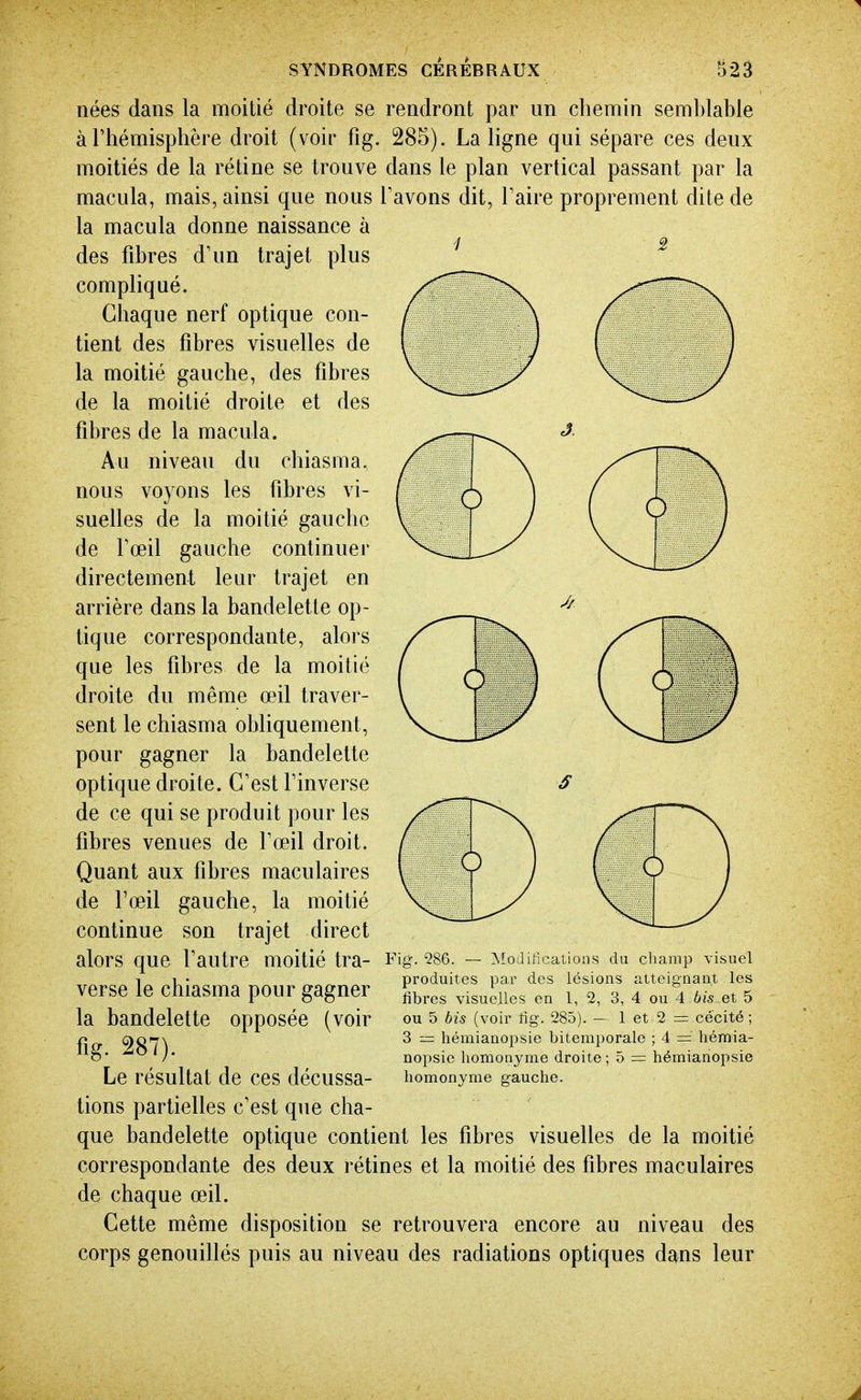 nées dans la moitié droite se rendront par un chemin sem])lable à l'hémisphère droit (voir fig. 285). La ligne qui sépare ces deux moitiés de la rétine se trouve dans le plan vertical passant par la macula, mais, ainsi que nous Pavons dit, Taire proprement dite de la macula donne naissance à des fibres d'un trajet plus compliqué. Chaque nerf optique con- tient des fibres visuelles de la moitié gauche, des fibres de la moitié droite et des fibres de la macula. Au niveau du chiasma. nous voyons les fibres vi- suelles de la moitié gauche de foeil gauche continuer directement leur trajet en arrière dans la bandelette op- tique correspondante, alors que les fibres de la moitié droite du même œil traver- sent le chiasma obliquement, pour gagner la bandelette optique droite. C'est l'inverse de ce qui se produit pour les fibres venues de l'œil droit. Quant aux fibres maculaires de l'œil gauche, la moitié continue son trajet direct alors que l'autre moitié tra- verse le chiasma pour gagner la bandelette opposée (voir fig. 287). Le résultat de ces décussa- tions partielles c'est que cha- que bandelette optique contient les fibres visuelles de la moitié correspondante des deux rétines et la moitié des fibres maculaires de chaque œil. Cette même disposition se retrouvera encore au niveau des corps genouillés puis au niveau des radiations optiques dans leur Fig. 286. — ^lodifications du champ visuel produites par des lésions atteignant les fibres visuelles en 1, 2, 3, 4 ou 4 bis et 5 ou 5 bis (voir hg. 285). — I et 2 = cécité ; 3 = hémianopsie bitemporale ; 4 = hémia- nopsie liomonyme droite; 5 = hémianopsie homonyme gauche.