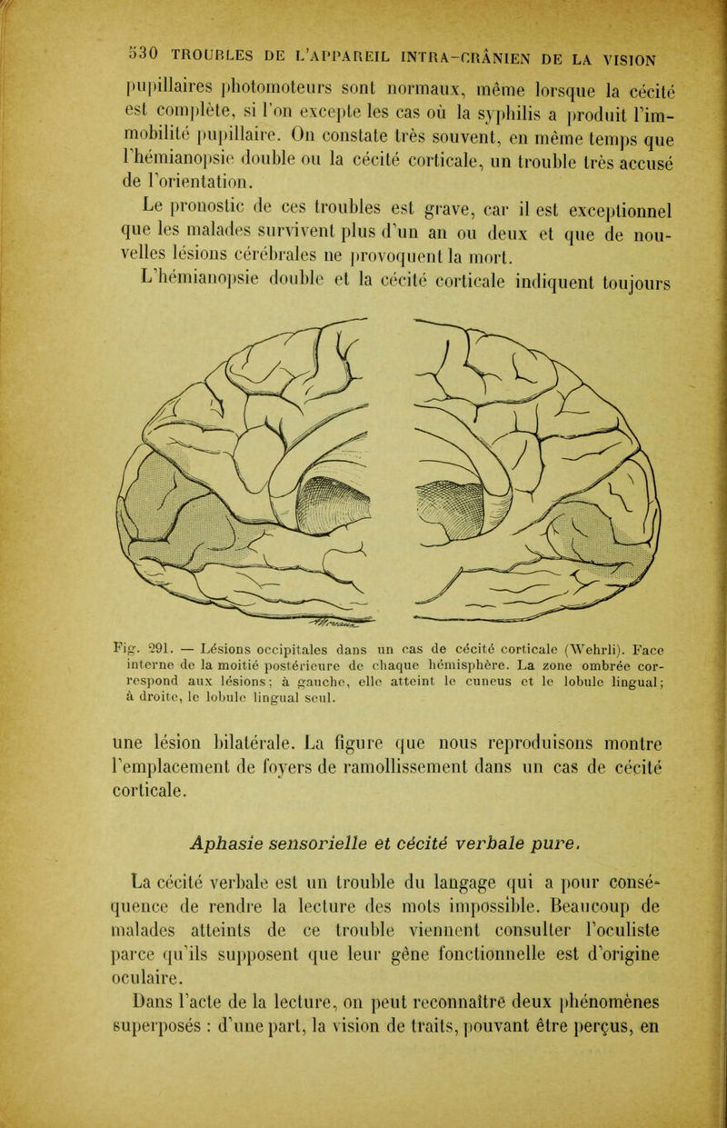 piq)illaires photomoteurs sont normaux, même lorsque la cécité est complète, si l'on excepte les cas où la syphilis a produit Tim- mobilité pupillaire. On constate très souvent, en même temps que rhémianopsie double ou la cécité corticale, un trouble très accusé de Torientation. Le pronostic de ces troubles est grave, car il est exceptionnel que les malades survivent plus d\m an ou deux et que de nou- velles lésions cérébrales ne provoquent la mort. L^hémianopsie double et la cécité corticale indiquent toujours Pig. 291. — Lésions occipitales dans un cas de cécité corticale (Wehrli). Face interne de la moitié postérieure de chaque hémisphère. La zone ombrée cor- respond aux lésions; à gauche, elle atteint le cuneus et le lobule lingual; à droite, le lobule lingual seul. une lésion bilatérale. La figure que nous reproduisons montre remplacement de foyers de ramollissement dans un cas de cécité corticale. Aphasie sensorielle et cécité verbale pure. La cécité verbale est un trouble du langage qui a pour consé- quence de rendre la lecture des mots impossible. Beaucoup de malades atteints de ce trouble viennent consulter Toculiste parce qu'ils supposent que leur gêne fonctionnelle est d'origine oculaire. Dans lacté de la lecture, on peut reconnaître deux phénomènes superposés : d'une part, la vision de traits, ])ouvant être perçus, en