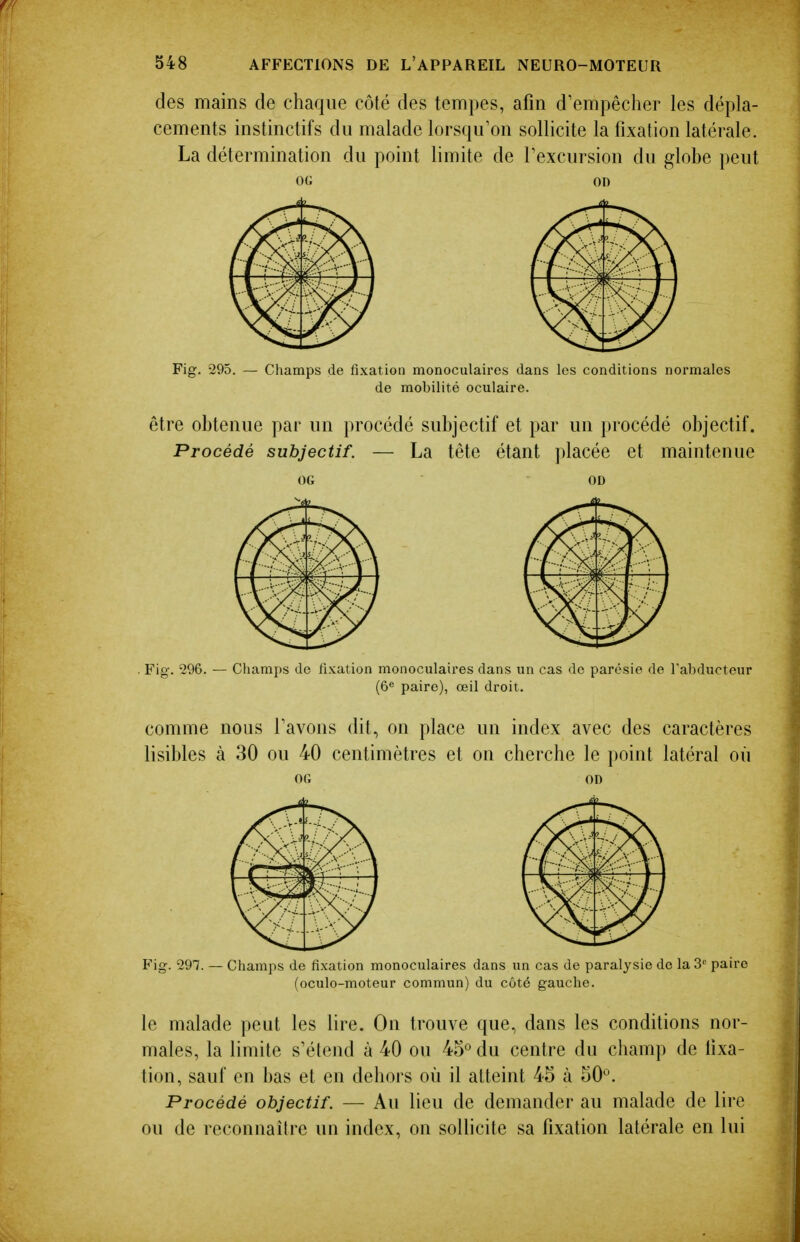 des mains de chaque côté des tempes, afin d'empêcher les dépla- cements instinctifs du malade lorsqu'on sollicite la fixation latérale. La détermination du point limite de l'excursion du globe peut Fig. 295. — Champs de fixation monoculaires dans les conditions normales de mobilité oculaire. être obtenue par un procédé subjectif et par un })rocédé objectif. Procédé subjectif. — La tête étant placée et maintenue OG OD . Fig. 296. — Champs do fixation monoculaires dans un cas de parésie de l'abducteur (6« paire), œil droit. comme nous l'avons dit, on place un index avec des caractères lisibles à 30 ou 40 centimètres et on cherche le point latéral où OG OD Fig. 297. — Champs de fixation monoculaires dans un cas de paralysie de la 3 paire (oculo-moteur commun) du côté gauche. le malade peut les lire. On trouve que, dans les conditions nor- males, la limite s'étend à 40 ou 45° du centre du champ de fixa- tion, sauf en bas et en dehors où il atteint 45 à 50*^. Procédé objectif. — Au lieu de demander au malade de lire ou de reconnaître un index, on sollicite sa fixation latérale en lui