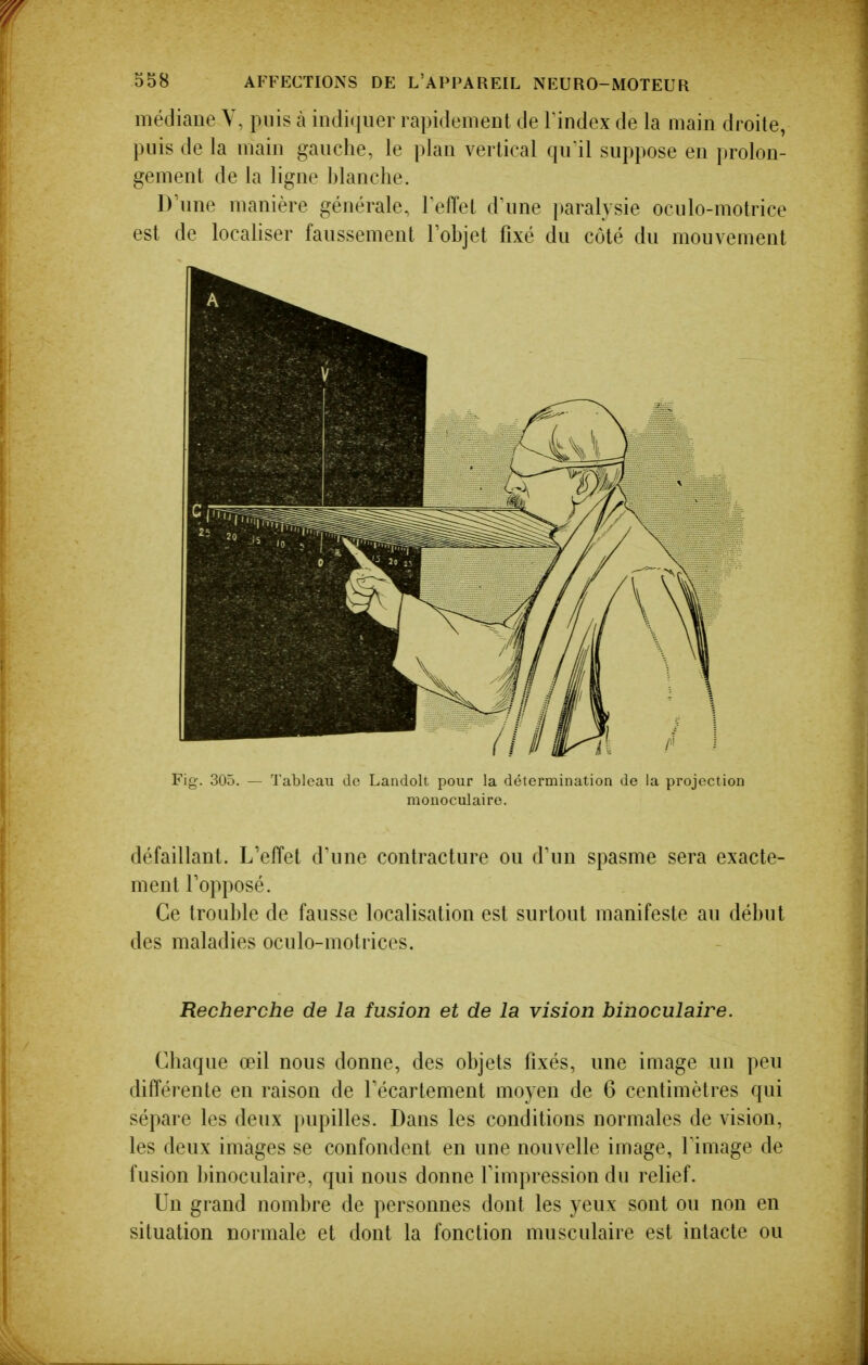 médiane Y, puis à indiquer rapidement de Tindex de la main droite, puis de la main gauche, le plan vertical qu'il suppose en prolon- gement de la ligne blanche. D'une manière générale, Teffet d\me paralysie oculo-motrice est de localiser faussement Tobjet fixé du côté du mouvement Fig. 305. — Tableau de Landolt pour la détermination de la projection monoculaire. défaillant. L'effet d'une contracture ou d'un spasme sera exacte- ment l'opposé. Ce trouble de fausse localisation est surtout manifeste au début des maladies oculo-motrices. Recherche de la fusion et de la vision binoculaire. Chaque œil nous donne, des objets fixés, une image un peu différente en raison de Técartement moyen de 6 centimètres qui sépare les deux pupilles. Dans les conditions normales de vision, les deux images se confondent en une nouvelle image, l'image de fusion binoculaire, qui nous donne l'impression du relief. Un grand nombre de personnes dont les yeux sont ou non en situation normale et dont la fonction musculaire est intacte ou