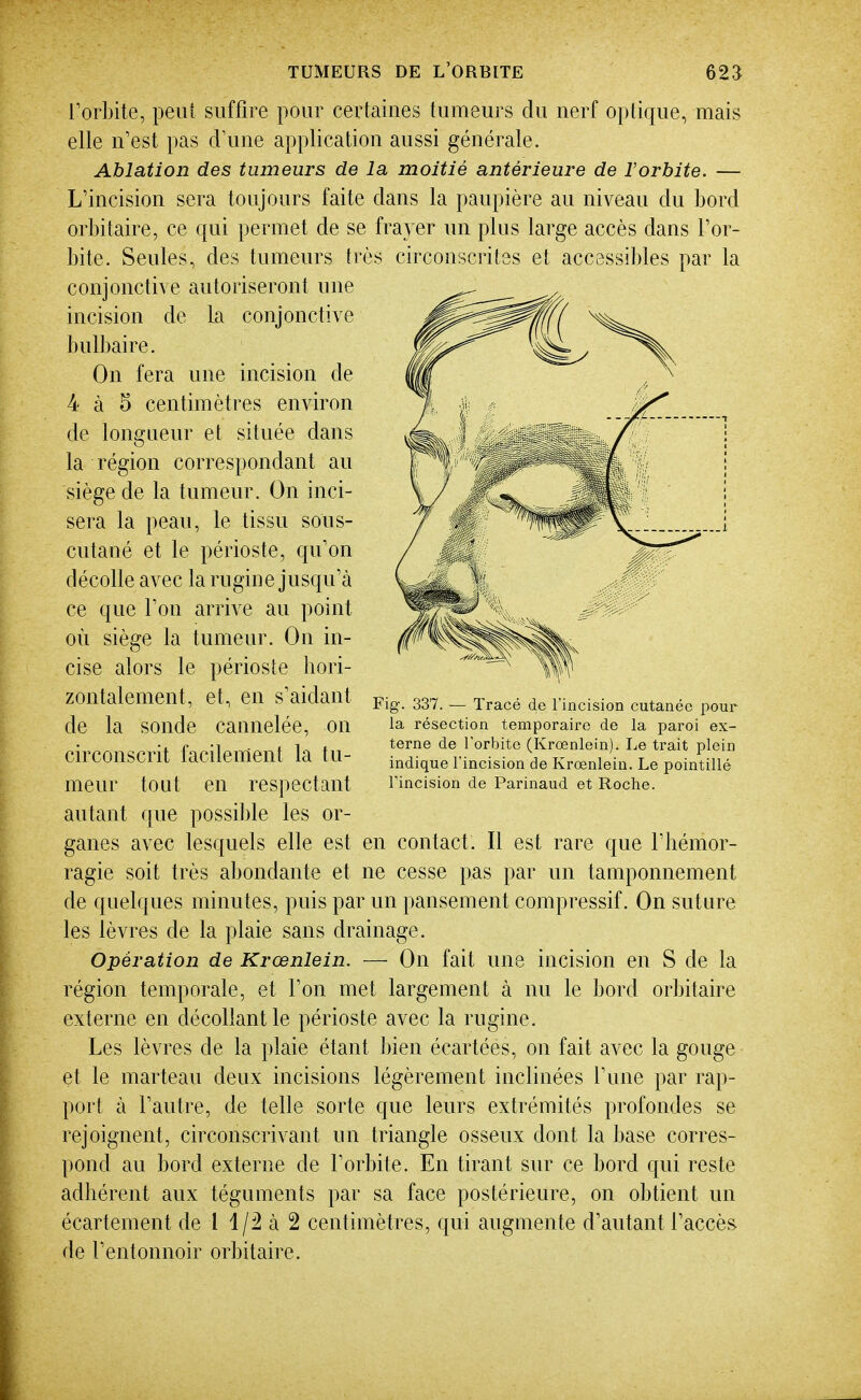 l'orbite, peut suffire pour certaines tumeurs du nerf optique, mais elle n'est pas d'une application aussi générale. Ablation des tumeurs de la moitié antérieure de ïorbite. — L'incision sera toujours faite dans la paupière au niveau du bord orbitaire, ce qui permet de se frayer un plus large accès dans l'or- bite. Seules, des tumeurs très circonscrites et accessibles par la conjonctive autoriseront une incision de la conjonctive bulbaire. On fera une incision de 4 à 5 centimètres environ de longueur et située dans la région correspondant au siège de la tumeur. On inci- sera la peau, le tissu sous- cutané et le périoste, qu'on décolle avec la rugine jusqu'à ce que l'on arrive au point où siège la tumeur. On in- cise alors le périoste hori- zontalement, et, en s'aidant de la sonde cannelée, on circonscrit facilement la tu- meur tout en respectant autant que possible les or- ganes avec lesquels elle est en contact. Il est rare que l'hémor- ragie soit très abondante et ne cesse pas par un tamponnement de quelques minutes, puis par un pansement compressif. On suture les lèvres de la plaie sans drainage. Opération de Krœnlein. — On fait une incision en S de la région temporale, et l'on met largement à nu le bord orbitaire externe en décollant le périoste avec la rugine. Les lèvres de la plaie étant bien écartées, on fait avec la gouge et le marteau deux incisions légèrement inclinées l'une par rap- port à l'autre, de telle sorte que leurs extrémités profondes se rejoignent, circonscrivant un triangle osseux dont la base corres- pond au bord externe de l'orbite. En tirant sur ce bord qui reste adhérent aux téguments par sa face postérieure, on obtient un écartement de l à 2 centimètres, qui augmente d'autant l'accès de l'entonnoir orbitaire. g. 337. — Tracé de l'incision cutanée pour la résection temporaire de la paroi ex- terne de l'orbite (Krœnlein). Le trait plein indique l'incision de Krœnlein. Le pointillé l'incision de Parinaud et Roche.
