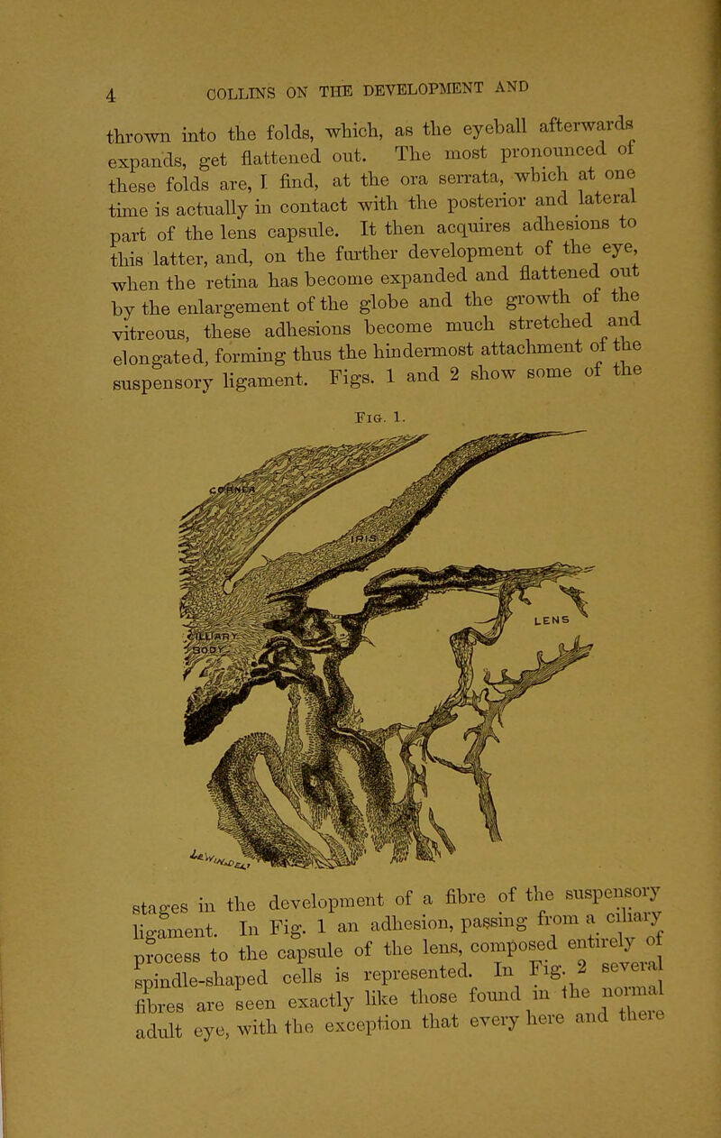 tlirown into the folds, which, as the eyeball afterwards expands, get flattened out. The most prononnced of these folds are, I find, at the ora serrata, which at one tune is actually in contact with the posterior and lateral part of the lens capsule. It then acquires adhesions to this latter, and, on the fui'ther development of the eye when the retina has become expanded and flattened out by the enlargement of the globe and the growth of the vitreous, these adhesions become much stretched and elongated, forming thus the hmdermost attachment of the suspensory Hgament. Figs. 1 and 2 show some of the Fig. 1. stages in the development of a fibre of the euspe^o y HgLent. In Fig. 1 an adherion, passing from .a c toy pfocesB to the capsule of the lens composed entuely of Lndle-shaped cells is represented. In Fig. 2 seve.a Xes are seen exactly like those found in the nc^ma adult eye, with the exception that every here and theie
