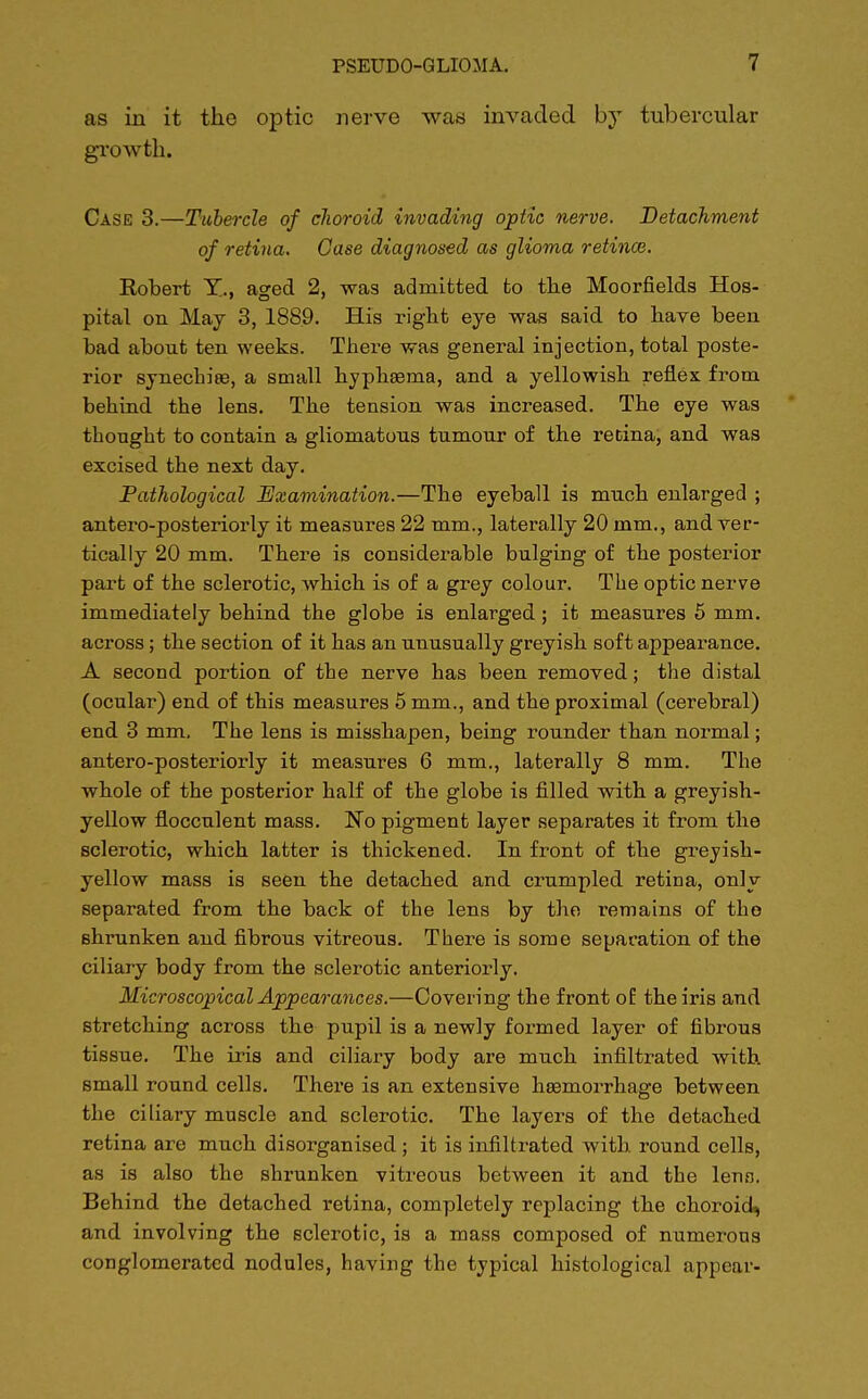 as in it the optic nerve was invaded by tubercular growth. Case 3.—Tubercle of choroid invading optic nerve. Detachment of retina. Case diagnosed as glioma retinae. Eobert X., aged 2, was admitted to the Moorfields Hos- pital on May 3, 1889. His right eye was said to have been had about ten weeks. There was general injection, total poste- rior synechias, a small hyphaama, and a yellowish reflex from behind the lens. The tension was increased. The eye was thought to contain a gliomatous tumour of the retina, and was excised the next day. Pathological Examination.—The eyeball is much enlarged ; antero-posteriorly it measures 22 mm., laterally 20 mm., and ver- tically 20 mm. There is considerable bulging of the posterior part of the sclerotic, which is of a grey colour. The optic nerve immediately behind the globe is enlarged ; it measures 5 mm. across; the section of it has an unusually greyish soft appearance. A second portion of the nerve has been removed; the distal (ocular) end of this measures 5 mm., and the proximal (cerebral) end 3 mm. The lens is misshapen, being rounder than normal; antero-posteriorly it measures 6 mm., laterally 8 mm. The whole of the posterior half of the globe is filled with a greyish- yellow flocculent mass. No pigment layer separates it from the sclerotic, which latter is thickened. In front of the greyish- yellow mass is seen the detached and crumpled retina, only separated from the back of the lens by the remains of the shrunken and fibrous vitreous. There is some separation of the ciliary body from the sclerotic anteriorly. Microscopical Appearances.—Covering the front of the iris and stretching across the pupil is a newly formed layer of fibrous tissue. The iris and ciliary body are much infiltrated with small round cells. There is an extensive hemorrhage between the ciliary muscle and sclerotic. The layers of the detached retina are much disorganised ; it is infiltrated with round cells, as is also the shrunken vitreous between it and the lens. Behind the detached retina, completely replacing the choroid, and involving the sclerotic, is a mass composed of numerous conglomerated nodules, having the typical histological appear-