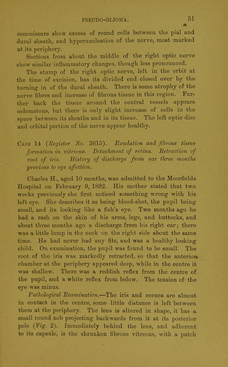 commissure show excess of round cells between the pial and dural sheath, and hypernucleation of the nerve, most marked at its periphery. Sections from about the middle of the right optic nerve show similar inflammatory changes, though less pronounced. The stump of the right optic nerve, left in the orbit at the time of excision, has its divided end closed over by the turning in of the dural sheath. There is some atrophy of the nerve fibres and increase of fibrous tissue in this region. Fur- ther back the tissue around the central vessels appears cedematous, but there is only slight increase of cells in the space between its sheaths and in its tissue. The left optic disc and orbital portion of the nerve appear healthy. Case 14 {Register No. 361.5). Exudation and fibrous tissue formation in vitreous. Detachment of retina. Retraction of root of iris. History of discharge from ear three months previous to eye affection. Charles H., aged 10 months, was admitted to the Moorfielda Hospital on February 9, 1892. His mother stated that two weeks previously she first noticed something wrong with his left eye. She describes it as being blood-shot, the pupil being small, and its looking like a fish's eye. Two months ago he had a rash on the skin of his arms, legs, and buttocks, and about three months ago a discharge from his right ear; there was a little lump in the neck on the right side about the same time. He had never had any fits, and was a healthy looking child. On examination, the pupil was found to be small. The root of the iris was markedly retracted, so that the anterior- chamber at the periphery appeared deep, while in the centre it was shallow. There was a reddish reflex from the centre of the pupil, and a white reflex from below. The tension of the eye was minus. Pathological Examination.—The iris and cornea are almost in contact in the centre, some little distance is left between them at the periphery. The lens is altered in shape, it has a small round nob projecting backwards from it at its posterior pole (Fig. 2). Immediately behind the lens, and adherent to its capsule, is the shrunken fibrous vitreous, with a patch