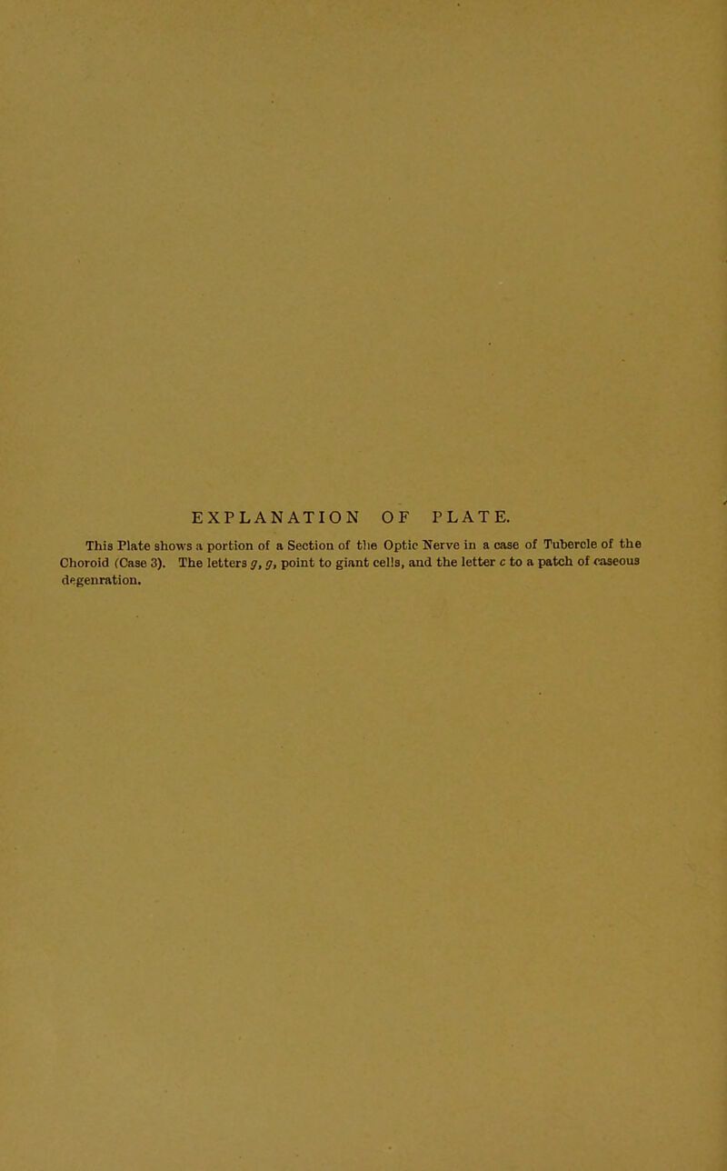 EXPLANATION OF PLATE. This Plate shows a portion of a Section of the Optic Nerve in a case of Tubercle of the Choroid (Case 3). The letters g, g, point to giant cells, and the letter c to a patch of caseous degenration.