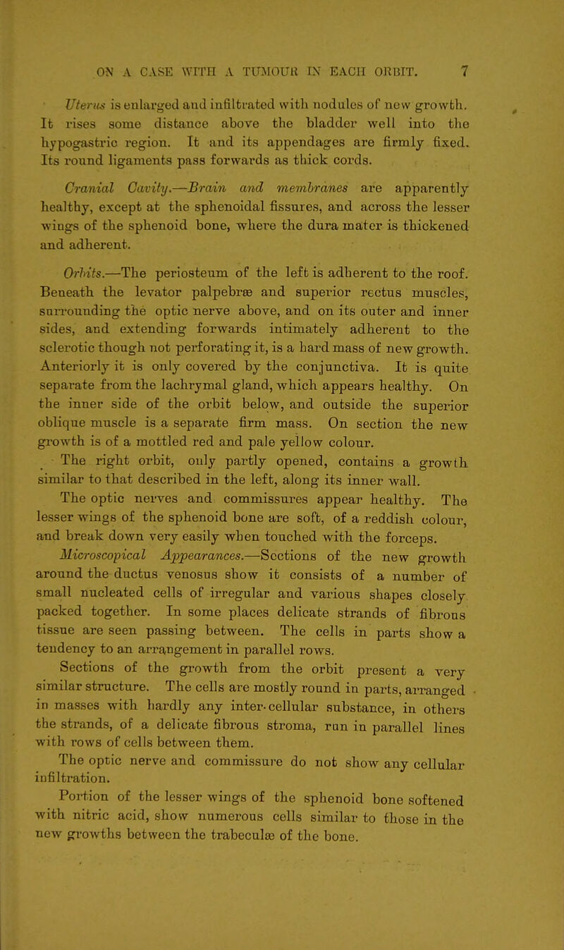 Utenis is enlarged and infiltrated with nodules of new growth. It rises some distance above the bladder well into the hypogastric region. It and its appendages are firmly fixed. Its round ligaments pass forwards as thick cords. Cranial Cavity.—Brain and membranes are apparently healthy, except at the sphenoidal fissures, and across the lesser wings of the sphenoid bone, -whei'e the dura mater is thickened and adherent. Orhits.—The periosteum of the left is adherent to the roof. Beneath the levator palpebree and superior rectus muscles, surrounding the optic nerve above, and on its outer and inner sides, and extending forwards intimately adherent to the sclerotic though not perforating it, is a hard mass of new growth. Anteriorly it is only covered by the conjunctiva. It is quite separate from the lachrymal gland, which appears healthy. On the inner side of the orbit below, and outside the superior oblique muscle is a separate firm mass. On section the new growth is of a mottled red and pale yellow colour. The right orbit, only partly opened, contains a growth similar to that described in the left, along its inner wall. The optic nerves and commissures appear healthy. The lesser wings of the sphenoid bone are soft, of a reddish colour, and break down very easily when touched with the forceps. Microscopical Appearances.—Sections of the new growth around the ductus venosus show it consists of a number of small nucleated cells of irregular and various shapes closely packed together. In some places delicate strands of fibrous tissue are seen passing between. The cells in parts show a tendency to an arrangement in parallel rows. Sections of the growth from the orbit present a very similar structure. The cells are mostly round in parts, arranged in masses with hardly any inter-cellular substance, in others the strands, of a delicate fibrous stroma, run in parallel lines with rows of cells between them. The optic nerve and commissure do not show any cellular infiltration. Portion of the lesser wings of the sphenoid bone softened with nitric acid, show numerous cells similar to those in the new gn-owths between the trabeculsB of the bone.