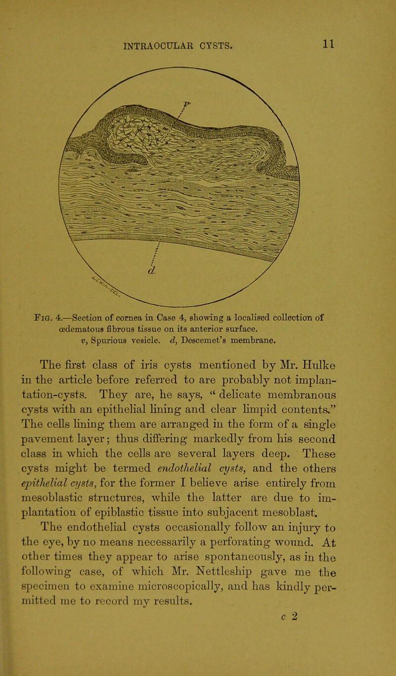 Fig. 4.—Section of cornea in Case 4, showing a localised collection of cedematous fibrous tissue on its anterior surface. v, Spurious vesicle, d, Descenaet's membrane. The first class of iris cysts mentioned by Mr. Hulke in the article before referred to are probably not implan- tation-cysts. They are, he says,  delicate membranous cysts with an epithelial lining and clear limpid contents. The cells lining them are arranged in the form of a single pavement layer; thus differing markedly from his second class in which the cells are several layers deep. These cysts might be termed endothelial cysts, and the others epithelial cysts, for the former I believe arise entirely from mesoblastic structures, while the latter are due to im- plantation of epiblastic tissue into subjacent mesoblast. The endothelial cysts occasionally follow an injury to the eye, by no means necessarily a perforating wound. At other times they appear to arise spontaneously, as in the following case, of which Mr. Nettleship gave me the specimen to examine microscopically, and has kindly per- mitted me to record my results. c 2