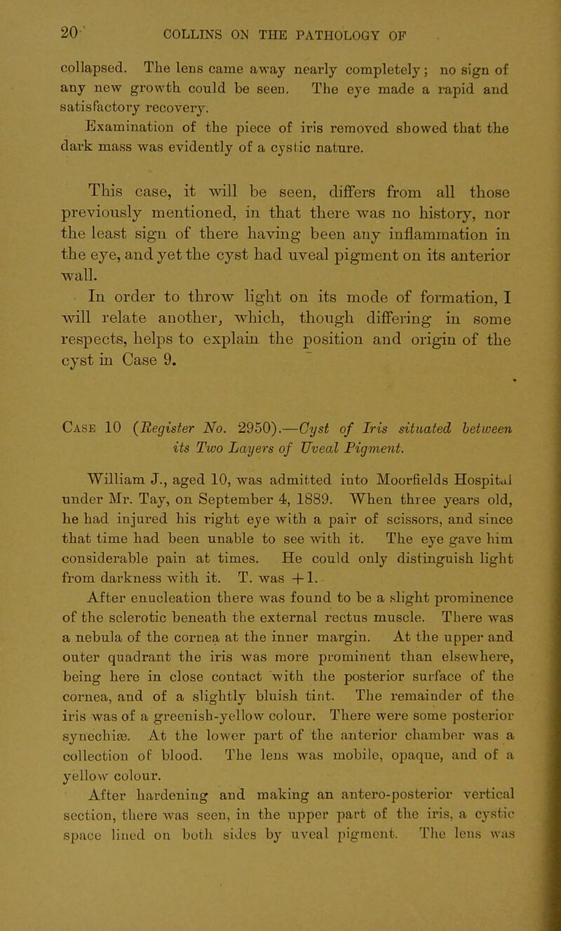 collapsed. The lens came away nearly completely; no sign of any new growth, could be seen. The eye made a rapid and satisfactory recovery. Examination of the piece of iris removed showed that the dark mass was evidently of a cystic nature. This case, it will be seen, differs from all those previously mentioned, in that there was no history, nor the least sign of there having been any inflammation in the eye, and yet the cyst had uveal pigment on its anterior wall. In order to throw light on its mode of formation, I will relate another, which, though differing in some respects, helps to explain the position and origin of the cyst in Case 9. Case 10 (Register No. 2950).—Cyst of Iris situated between its Two Layers of Uveal Pigment. William J., aged 10, was admitted into Moorfields Hospital under Mr. Tay, on September 4, 1889. When three years old, he had injured his right eye with a pair of scissors, and since that time had been unable to see with it. The eye gave him considerable pain at times. He could only distinguish light from darkness with it. T. was +L After enucleation there was found to be a slight prominence of the sclerotic beneath the external rectus muscle. There was a nebula of the cornea at the inner margin. At the upper and outer quadrant the iris was more prominent than elsewhere, being here in close contact with the posterior surface of the cornea, and of a slightly bluish tint. The remainder of the iris was of a greenish-yellow colour. There were some posterior synechias. At the lower part of the anterior chamber was a collection of blood. The lens was mobile, opaque, and of a yellow coloui*. After hardening and making an antero-posterior vertical section, there was seen, in the upper part of the iris, a cystic space lined on both sides by uveal pigment. The lens was