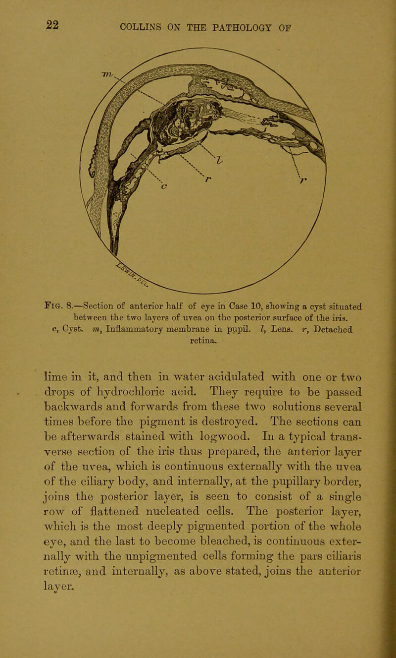 Fig. 8.—Section of anterior half of eye in Case 10, allowing a cyst situated between the two layers of uvea on the posterior surface of the iris, c, Cyst, m, Inflammatory membrane in pupil. I, Lens, r, Detached retina- lime in it, and then in water acidulated with one or two drops of hydrochloric acid. They require to be passed backwards and forwards from these two solutions several times before the pigment is destroyed. The sections can be afterwards stained with logwood. In a typical trans- verse section of the iris thus prepared, the anterior layer of the uvea, which is continuous externally with the uvea of the ciliary body, and internally, at the pupillary border, joins the posterior layer, is seen to consist of a single row of flattened nucleated cells. The posterior layer, which is the most deeply pigmented portion of the whole eye, and the last to become bleached, is continuous exter- nally with the unpigmented cells forming the pars ciliaris retinae, and internally, as above stated, joins the anterior layer.