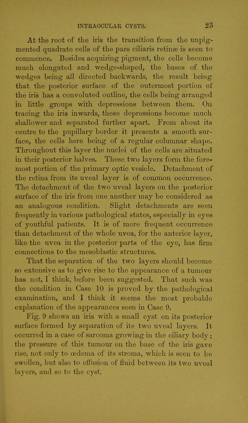 At the root of the iris the transition from the unpig- mented quadrate cells of the pars ciliaris retinae is seen to commence. Besides acquiring pigment, the cells become much elongated and wedge-shaped, the bases of the wedges being all directed backwards, the result being that the posterior surface of the outermost portion of the iris has a convoluted outline, the cells being arranged in little groups with depressions between them. On tracing the iris inwards, these depressions become much shallower and separated further apart. From about its centre to the pupillary border it presents a smooth sur- face, the cells here being of a regular columnar shape. Throughout this layer the nuclei of the cells are situated in their posterior halves. These two layers form the fore- most portion of the primary optic vesicle. Detachment of the retina from its uveal layer is of common occurrence. The detachment of the two uveal layers on the posterior surface of the iris from one another may be considered as an analogous condition. Slight detachments are seen frequently in various pathological states, especially in eyes of youthful patients. It is of more frequent occurrence than detachment of the whole uvea, for the anterior layer, like the uvea in the posterior parts of the eye, has firm connections to the mesoblastic structures. That the separation of the two layers should become so extensive as to give rise to the appearance of a tumour has not, I think, before been suggested. That such was the condition in Case 10 is proved by the pathological examination, and I think it seems the most probable explanation of the appearances seen in Case 9. Fig. 9 shows an iris with a small cyst on its posterior smrface formed by separation of its two uveal layers. It occurred in a case of sarcoma growing in the ciliary body; the pressure of this tumour on the base of the iris gave rise, not only to oedema of its stroma, which is seen to be swollen, but also to effusion of fluid between its two uveal layers, and so to the cyst.