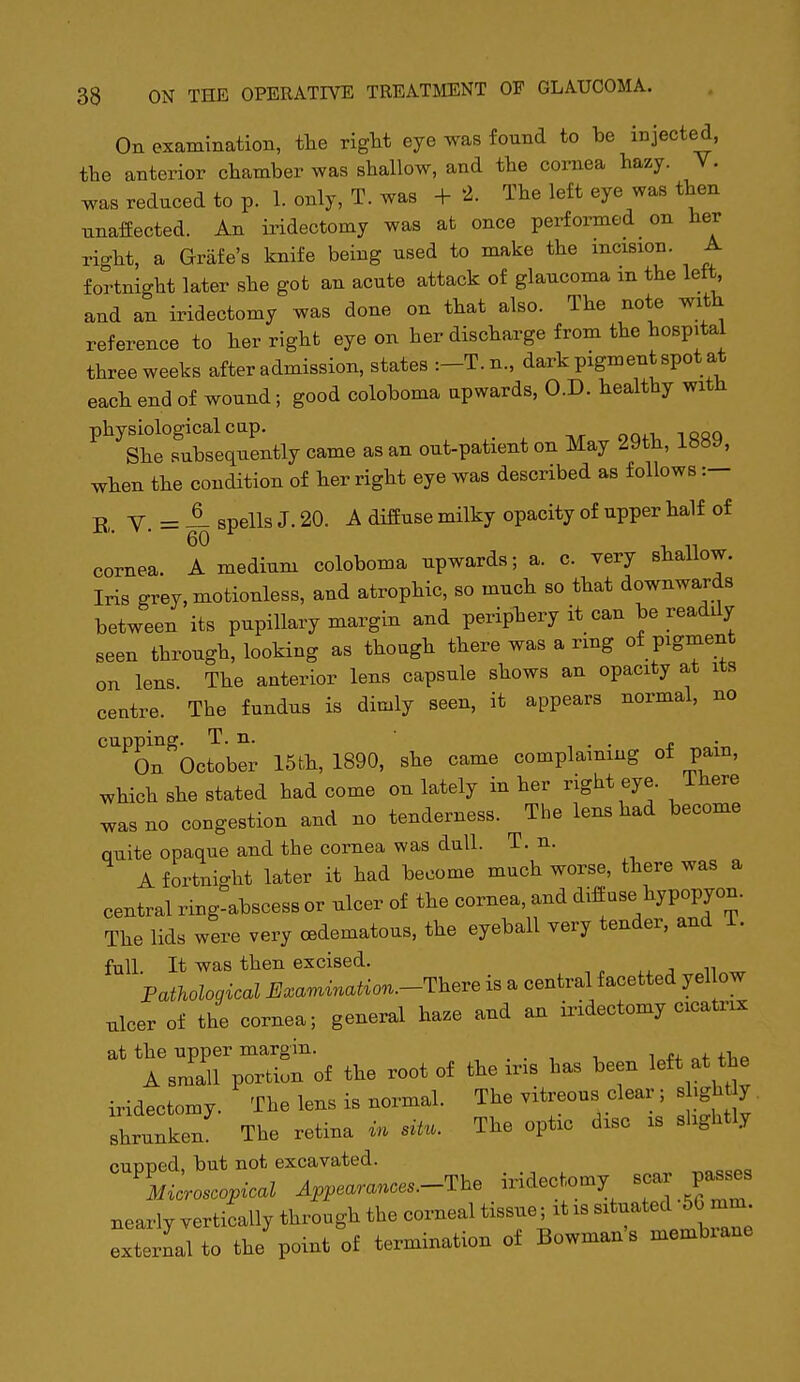 On examination, tlie rigM eye was fonnd to be injected, the anterior chamber was shallow, and the cornea hazy. Y. was rednced to p. 1. only, T. was + 2. The left eye was then unaffected. An iridectomy was at once performed on her right, a Grafe's knife being used to make the incision. A fortnight later she got an acute attack of glaucoma m the left and an iridectomy was done on that also. The note with reference to ber right eye on her discharge from the hospital three weeks after admission, states :-T.n., dark pigment spot at each end of wound; good coloboma upwards, O.D. healthy with physiological cap. i qqq She subsequently came as an out-patient on May 29th, 1889, wben the condition of her right eye was described as follows :- 2„ Y. = A spells J. 20. A diffuse milky opacity of upper half of cornea. A medium coloboma upwards; a. c. very sballow. Iris grey, motionless, and atrophic, so much so that downwards between its pupillary margin and peripbery it can be readdy seen through, looking as though there was a ring of pigment on lens. The anterior lens capsule shows an opacity at its centre. The fundus is dimly seen, it appears normal, no cupping. T. n. -, . • i; •„ Ou October 15th, 1890, she came complaining of pam, which she stated had come on lately in her right eye. There was no congestion and no tenderness. The lens had become quite opaque and the cornea was dull. T. n. A fortnight later it had become much worse, there was a central ring-abscess or ulcer of the cornea, and diffuse hypopyon. The lids were very cedematous, the eyeball very tender, and i. full It was then excised. Pathological JSxa^ination.-Theve is a central facetted yellow ulcer of the cornea; general haze and an ii.dectomy cicatrix at the upper margin. , . . i. v A small portion of the root of the ins has been left at the iridectomy. The lens is normal. The vitreous clear; slight y shrunken The retina in situ. The optic disc is slightly cupped, but not excavated. Microscopical Appearances.-The iridec omy Bcar passes nearly vertically through the corneal tissue; it is situated 5G mm external to the point of termination of Bowman's membrane