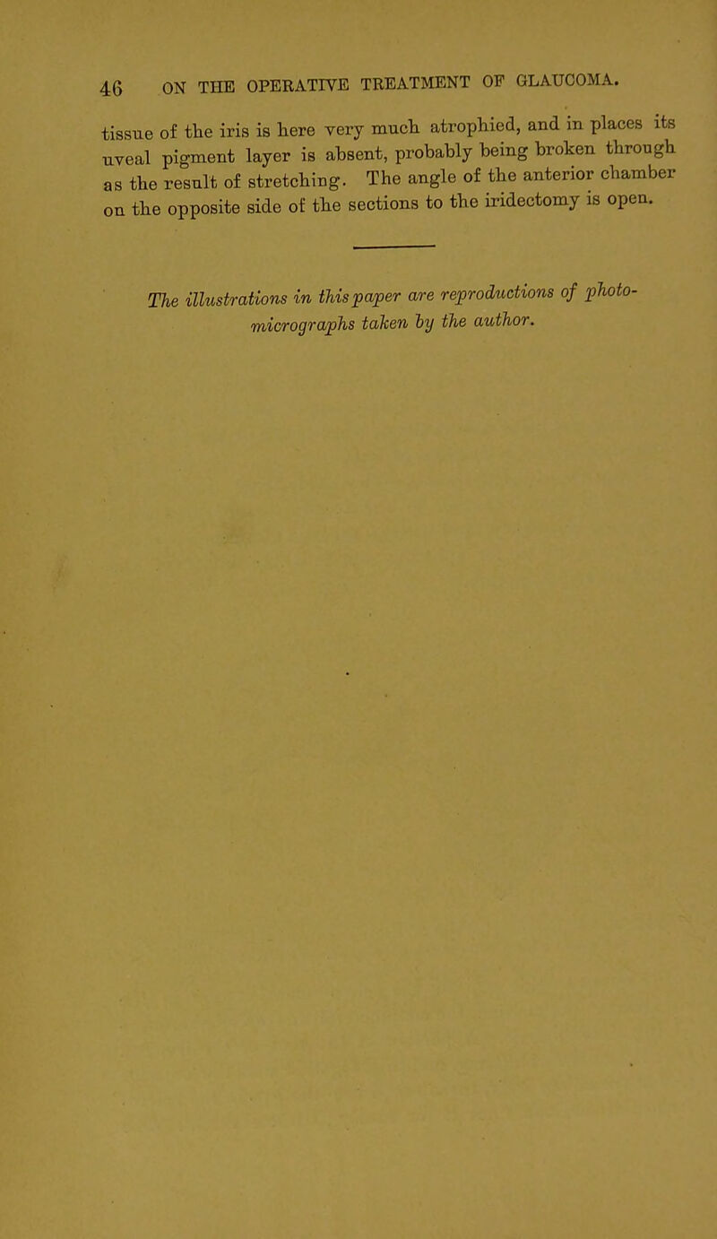 tissue of the iris is here very much atrophied, and in places its uveal pigment layer is absent, probably being broken through as the result of stretching. The angle of the anterior chamber on the opposite side of the sections to the iridectomy is open. The illustrations in this paper are reproductions of photo- micrographs taken ly the author.