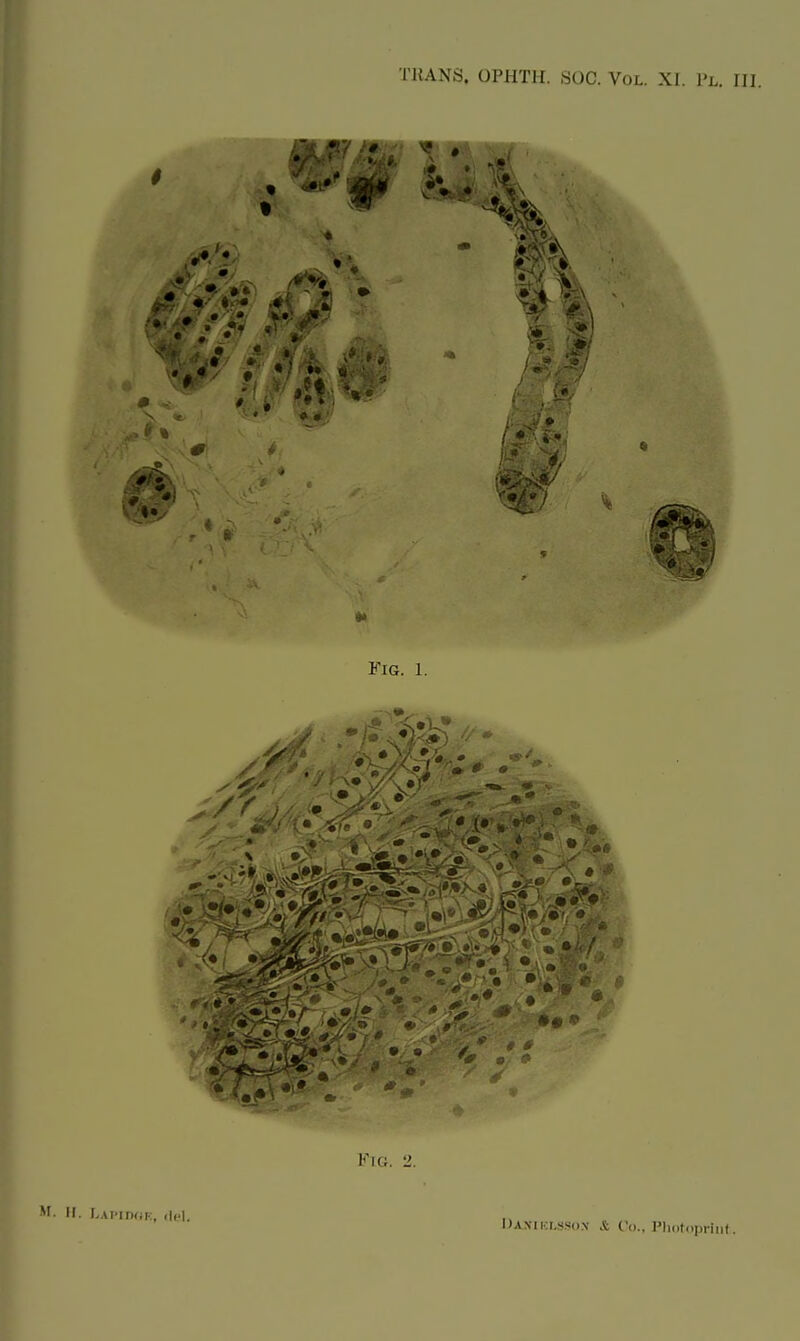 • it * • •» 4! St r^J Fig. l. Fig. 2. M. H. Lapcdoe, del. Daniglsson Jb Co., Photopriut.