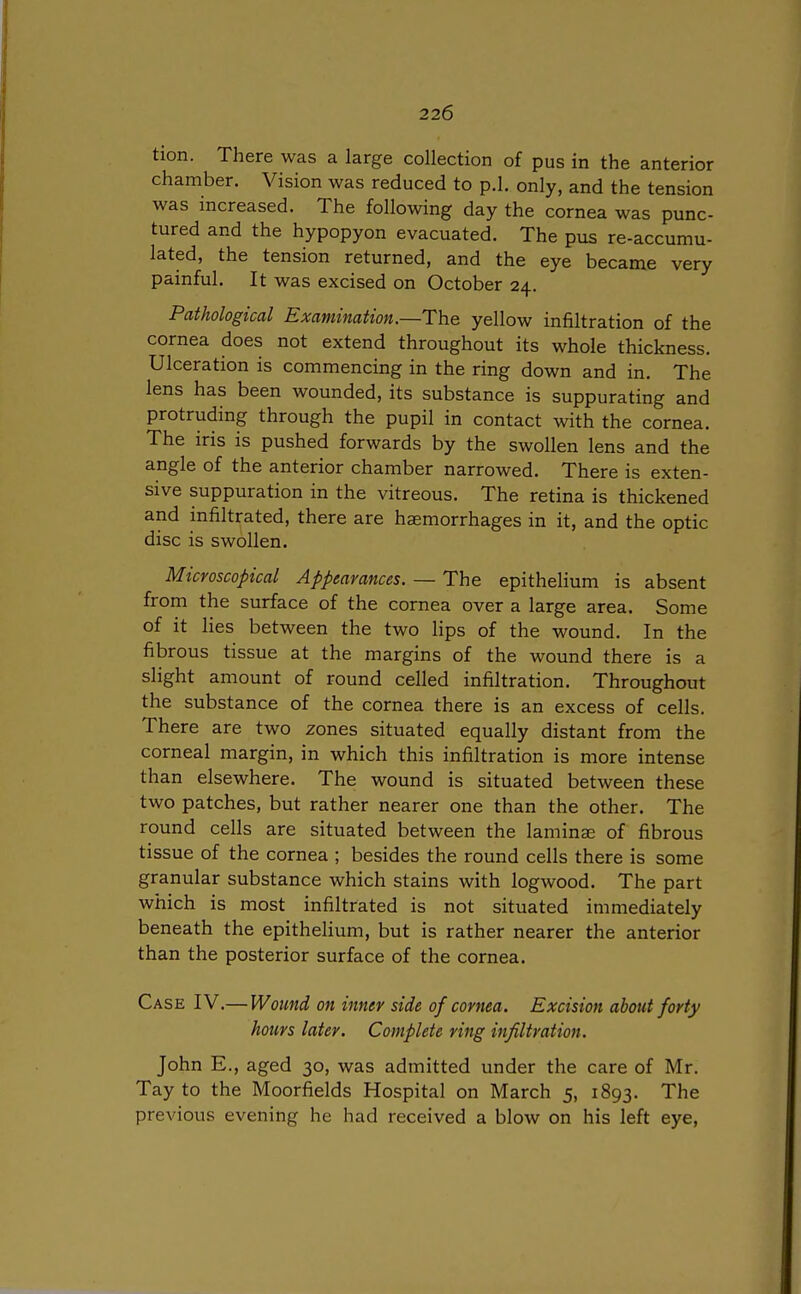 tion. There was a large collection of pus in the anterior chamber. Vision was reduced to p.l. only, and the tension was increased. The following day the cornea was punc- tured and the hypopyon evacuated. The pus re-accumu- lated, the tension returned, and the eye became very painful. It was excised on October 24. Pathological Examination.—-The yellow infiltration of the cornea does not extend throughout its whole thickness. Ulceration is commencing in the ring down and in. The lens has been wounded, its substance is suppurating and protruding through the pupil in contact with the cornea. The iris is pushed forwards by the swollen lens and the angle of the anterior chamber narrowed. There is exten- sive suppuration in the vitreous. The retina is thickened and infiltrated, there are haemorrhages in it, and the optic disc is swollen. Microscopical Appearances. — The epithelium is absent from the surface of the cornea over a large area. Some of it lies between the two lips of the wound. In the fibrous tissue at the margins of the wound there is a slight amount of round celled infiltration. Throughout the substance of the cornea there is an excess of cells. There are two zones situated equally distant from the corneal margin, in which this infiltration is more intense than elsewhere. The wound is situated between these two patches, but rather nearer one than the other. The round cells are situated between the laminae of fibrous tissue of the cornea ; besides the round cells there is some granular substance which stains with logwood. The part which is most infiltrated is not situated immediately beneath the epithelium, but is rather nearer the anterior than the posterior surface of the cornea. Case IV.— Wound on inner side of cornea. Excision about forty hours later. Complete ring infiltration. John E., aged 30, was admitted under the care of Mr. Tay to the Moorfields Hospital on March 5, 1893. The previous evening he had received a blow on his left eye,