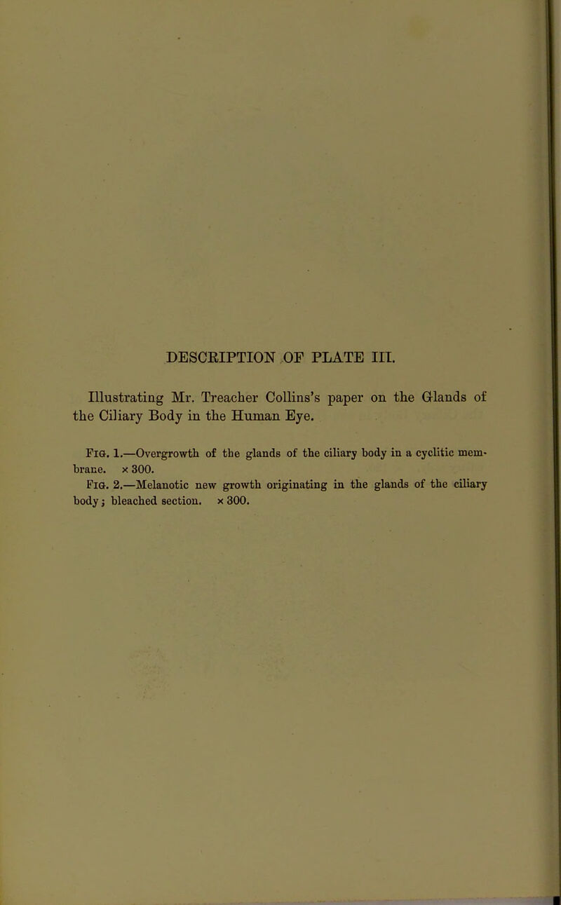 Illustrating Mr. Treacher Collins's paper on the Grlands of the Ciliary Body in the Human Eye. FlG. 1.—Overgrowth of the glands of the ciliary body in a cyclitic mem- brane, x 300. FlG. 2.—Melanotic new growth originating in the glands of the ciliary
