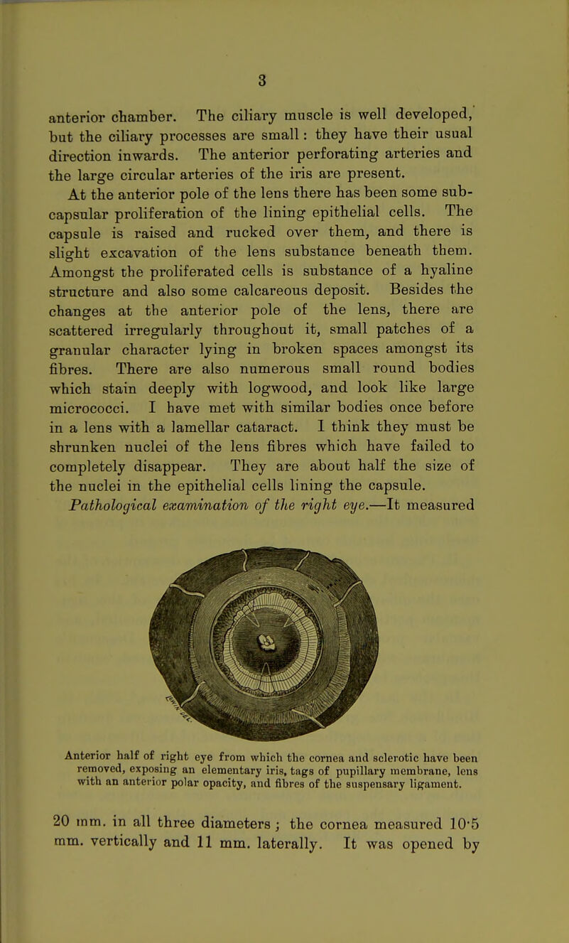 anterior chamber. The ciliary muscle is well developed, but the ciliary processes are small: they have their usual direction inwards. The anterior perforating arteries and the large circular arteries of the iris are present. At the anterior pole of the lens there has been some sub- capsular proliferation of the lining epithelial cells. The capsule is raised and rucked over them, and there is slight excavation of the lens substance beneath them. Amongst the proliferated cells is substance of a hyaline structure and also some calcareous deposit. Besides the changes at the anterior pole of the lens, there are scattered irregularly throughout it, small patches of a granular character lying in broken spaces amongst its fibres. There are also numerous small round bodies which stain deeply with logwood, and look like large micrococci. I have met with similar bodies once before in a lens with a lamellar cataract. 1 think they must be shrunken nuclei of the lens fibres which have failed to completely disappear. They are about half the size of the nuclei in the epithelial cells lining the capsule. Pathological examination of the right eye.—It measured Anterior half of right eye from which the cornea and sclerotic have been removed, exposing an elementary iris, tags of pupillary membrane, lens with an anterior polar opacity, and fibres of the suspensary ligament. 20 mm. in all three diameters ; the cornea measured 10'5 mm. vertically and 11 mm. laterally. It was opened by