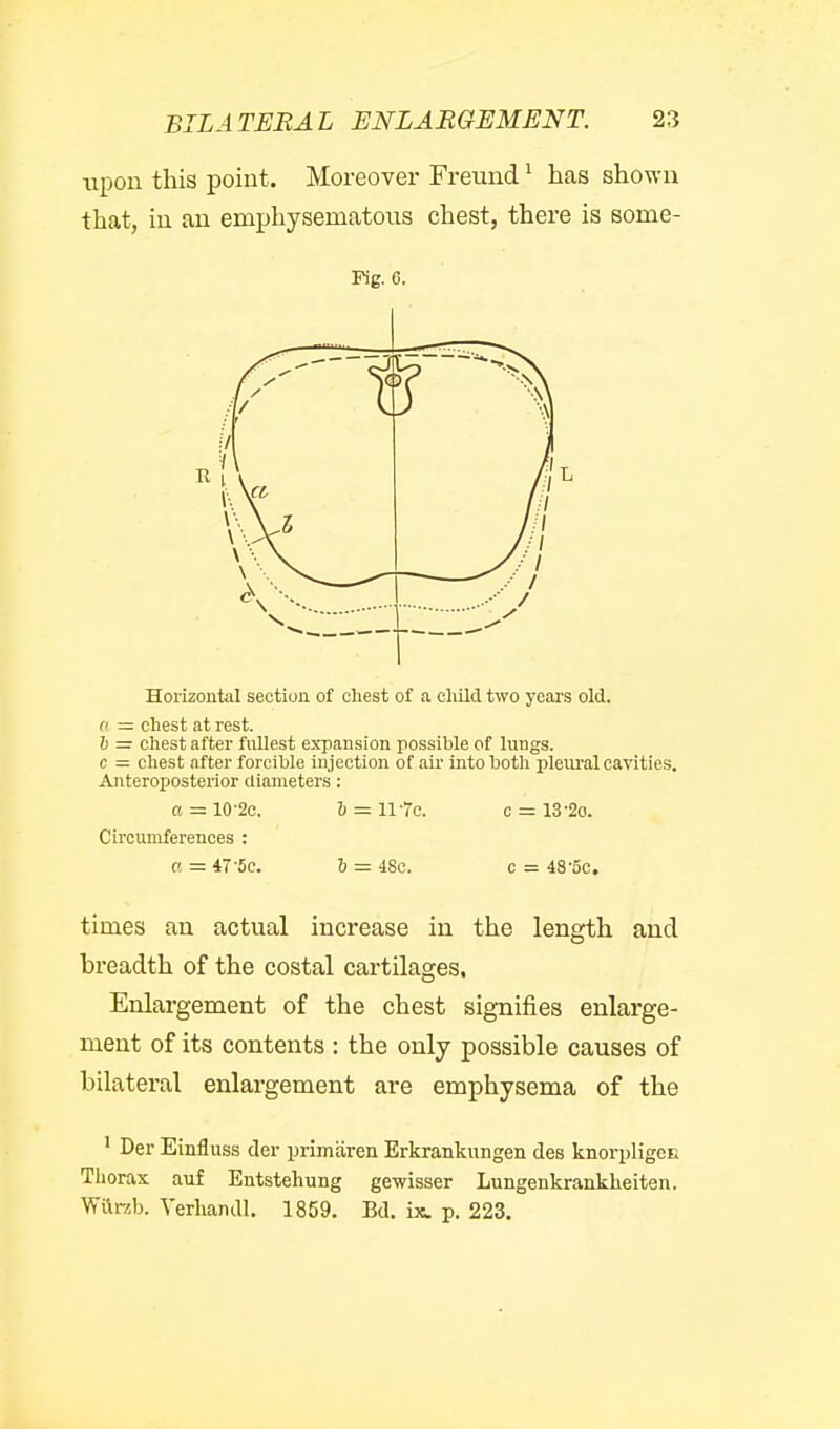 upon this point. Moreover Freund' has shown that, in an emphysematous chest, there is some- Fig. 6. Horizontal section of chest of a child two yeai's old. f! = chest at rest. h = chest after fullest expansion possible of lungs. c = chest after forcible injection of air into both pleural cavities. Anteroposterior diameters: a -10-20. 6 — 117c. c = 13'20. Circumferences : a = 47-Sc. & =: 4Sc. c = 48'5c. times an actual increase in the length and breadth of the costal cartilages. Enlargement of the chest signifies enlarge- ment of its contents : the only possible causes of bilateral enlargement are emphysema of the ' Der Einfluss der primaren Erkrankungen des knorpligeu Thorax auf Entstehung gewisser Lungenkrankheiten. Wttrab. Yerlundl. 1859. Bd. ix. p. 223.