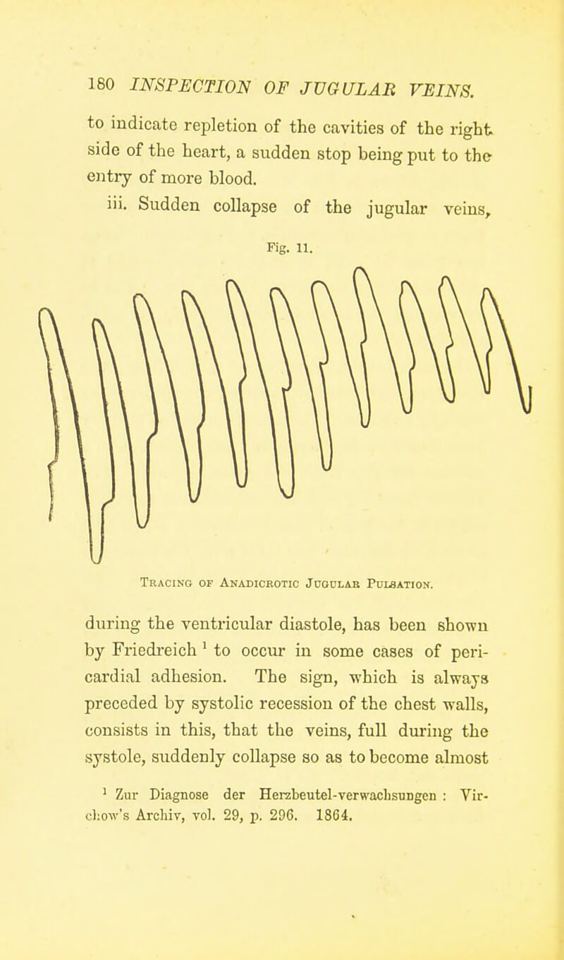 to indicate repletion of the cavities of the right side of the heart, a sudden stop being put to the entry of more blood. lii. Sudden collapse of the jugular veins. Fig. 11. Tracing of Anadicrotic Juoolab Pumation. during the ventricular diastole, has been shown by Friedreich' to occur in some cases of peri- cardial adhesion. The sign, -which is always preceded by systolic recession of the chest walls, consists in this, that the veins, full during the systole, suddenly collapse so as to become almost ^ Zur Diagnose der Herzbeutel-verwaclisuiigen : Vir- cliow's Archir, vol. 29, p. 296. 1864.