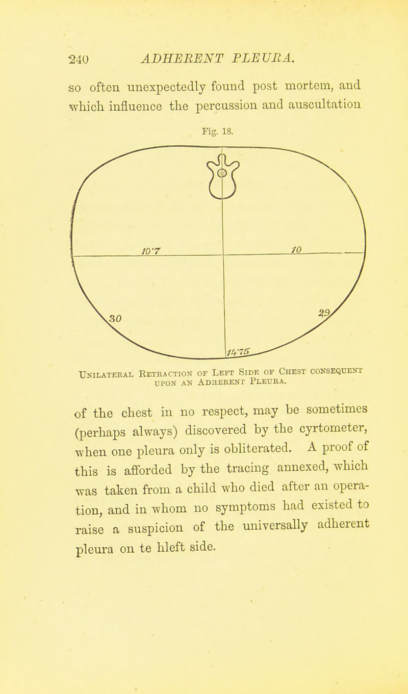 so often unexpectedly found post mortem, and which influence the percussion and auscultation Fig. 18. 10-7 in 1 Unilateeal Betraction of Left Side of Che.st consequent UPON AN ADHERBNI PlEURA. of the chest in no respect, may be sometimes (perhaps always) discovered by the cyi-tometer, Tvhen one pleura only is obliterated. A proof of this is afiorded by the tracing annexed, which was taken from a child who died after an opera- tion, and in whom no symptoms had existed to raise a suspicion of the universally adherent pleura on te hleft side.