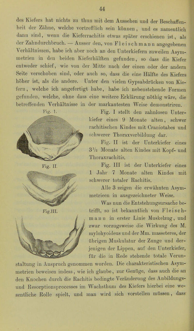 des Kiefers hat nichts zu thuii mit dem Aussehen und der Beschaffen- heit der Zähne, welche vortrefflich sein können, und es namentlich dann sind, wenn die Kieferrachitis etwas später erschienen ist, als der Zahndurchhruch. — Ausser den, von Fleischmann angegebenen Verhältnissen, habe ich aber noch an den Unterkiefern zuweilen Asym- metrien in den beiden Kieferhälften gefunden, so dass die Kiefer entweder schief, wie von der Mitte nach der einen oder der andern Seite verschoben sind, oder auch so, dass die eine Hälfte des Kiefers höher ist, als die andere. Unter den vielen Gypsabdrücken von Kie- fern, welche ich angefertigt habe, habe ich nebenstehende Formen gefundeu, welche, ohne dass eine weitere Erklärung nöthig wäre, die betreffenden Verhältnisse in der markantesten Weise demonstriren. Fig. I stellt den zahnlosen Unter- kiefer eines 9 Monate alten, schwer rachitischen Kindes mit Crauiotabes und ;^chwerer Thoraxverbilduug dar. Fig. II ist der Unterkiefer eines SVa Monate alten Kindes mit Kopf- und Thoraxrachitis. Fig. III ist der Unterkiefer eines 1 Jahr 7 Monate alten Kindes mit schwerer totaler Rachitis. Alle 3 zeigen die erwähnten Asym- metrieen in ausgezeichneter Weise. Was nun die Entstehungsursache be- trifft, so ist bekanntlich von Fl eise h- m a u n in erster Linie Muskelzug, und zwar vorzugsweise die Wirkung des M. mylohyoideus und der Mm. massetei'es, der übrigen Muskulatur der Zunge und der- jenigen der Lippen, auf den Unterkiefer, für die in Rede stehende totale Verun- staltung in Anspruch genommen worden. Die charakteristischen Asym- metrien beweisen indess, wie ich glaube, zur Genüge, dass auch die an den Knochen durch die Rachitis bedingte Veränderung des Anbilduugs- und Resorptionsprocesses im Wachsthum des Kiefers hierbei eine we- sentliche Rolle spielt, und man wird sich vorstellen müssen, dass