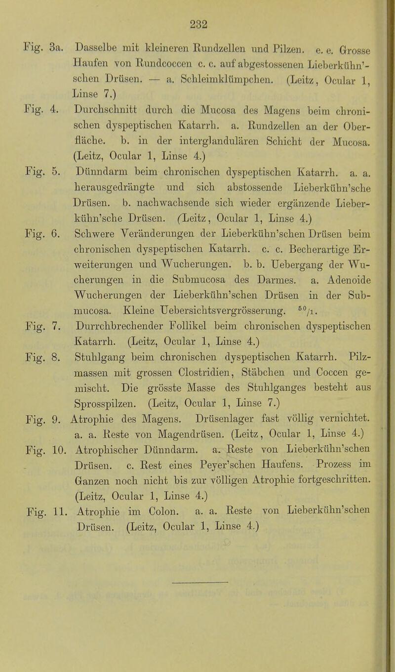 Fig. 3a. Dasselbe mit kleineren Rundzellen und Pilzen, e. e. Grosse Haufen von Rundcoccen c. c. auf abgestossenen Lieberkühn'- schen Drüsen. — a. Schleimklümpchen. (Leitz, Ocular 1, Linse 7.) Fig. 4. Durchschnitt durch die Mucosa des Magens beim chroni- schen dyspeptischen Katarrh, a. Rundzellen an der Ober- fläche, b. in der interglandulären Schicht der Mucosa. (Leitz, Ocular 1, Linse 4.) Fig. 5. Dünndarm beim chronischen dyspeptischen Katarrh, a. a. herausgedrängte und sich abstossende Lieberkühn'sche Drüsen, b. nachwachsende sich wieder ergänzende Lieber- kühn'sche Drüsen. fLeitz, Ocular 1, Linse 4.) Fig. 6. Schwere Veränderungen der Lieberkühn'schen Drüsen beim chronischen dyspeptischen Katarrh, c. c. Becherartige Er- weiterungen und Wucherungen, b. b. üebergaug der Wu- cherungen in die Submucosa des Darmes, a. Adenoide Wucherungen der Lieberkühn'schen Drüsen in der Sub- mucosa. Kleine Uebersichtsvergrösserung. ^/i. Fig. 7. Durrchbrechender Follikel beim chronischen dyspeptischen Katarrh. (Leitz, Ocular 1, Linse 4.) Fig. 8. Stuhlgang beim chronischen dyspeptischen Katarrh. Pilz- massen mit grossen Clostridien, Stäbchen und Coccen ge- mischt. Die grösste Masse des Stuhlganges besteht aus Sprosspilzen. (Leitz, Ocular 1, Linse 7.) Fig. 9. Atrophie des Magens. Drüsenlager fast völlig vernichtet. a. a. Reste von Magendrüseu, (Leitz, Ocular 1, Linse 4.) Fig. 10. Atrophischer Dünndarm, a. Reste von Lieberkühn'schen Drüsen, c. Rest eines Peyer'schen Haufens. Prozess im Ganzen noch nicht bis zur völligen Atrophie fortgeschritten. (Leitz, Ocular 1, Linse 4.) Fig. 11. Atrophie im Colon. a. a. Reste von Lieberkühn'schen Drüsen. (Leitz, Ocular 1, Linse 4.)