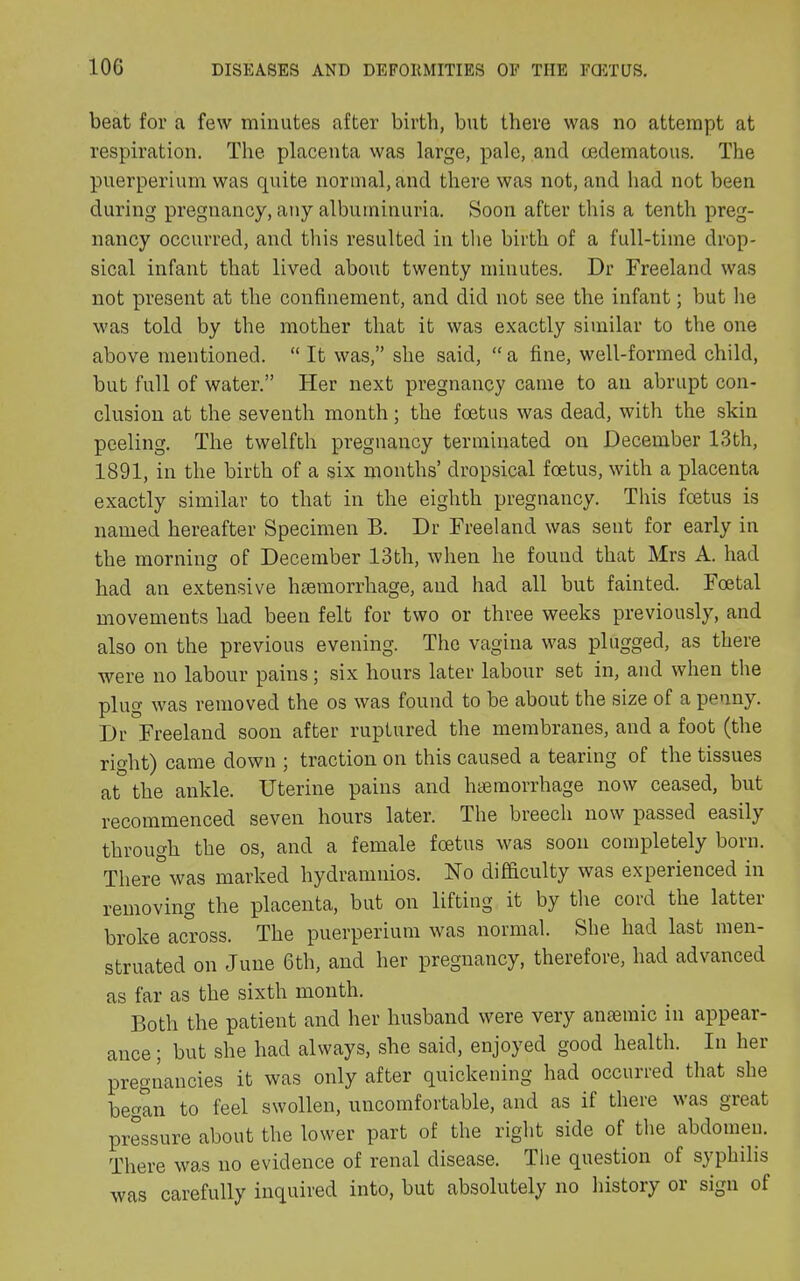 10G beat for a few minutes after birth, but there was no attempt at respiration. The placenta was large, pale, and (edematous. The puerperium was quite normal, and there was not, and had not been during pregnancy, any albuminuria. Soon after this a tenth preg- nancy occurred, and this resulted in the birth of a full-time drop- sical infant that lived about twenty minutes. Dr Freeland was not present at the confinement, and did not see the infant; but lie was told by the mother that it was exactly similar to the one above mentioned. “ It was,” she said, “ a fine, well-formed child, but full of water.” Her next pregnancy came to an abrupt con- clusion at the seventh month; the foetus was dead, with the skin peeling. The twelfth pregnancy terminated on December 13th, 1891, in the birth of a six months’ dropsical foetus, with a placenta exactly similar to that in the eighth pregnancy. This foetus is named hereafter Specimen B. Dr Freeland was sent for early in the morning of December 13th, when he found that Mrs A. had had an extensive luemorrhage, and had all but fainted. Foetal movements had been felt for two or three weeks previously, and also on the previous evening. The vagina was plugged, as there were no labour pains; six hours later labour set in, and when the plug was removed the os was found to be about the size of a penny. Dr Freeland soon after ruptured the membranes, and a foot (the right) came down ; traction on this caused a tearing of the tissues at the ankle. Uterine pains and haemorrhage now ceased, but recommenced seven hours later. The breech now passed easily through the os, and a female foetus was soon completely born. There was marked hydramnios. No difficulty was experienced in removing the placenta, but on lifting it by the cord the latter broke across. The puerperium was normal. She had last men- struated on June 6th, and her pregnancy, therefore, had advanced as far as the sixth month. Both the patient and her husband were very amemic in appear- ance; but she had always, she said, enjoyed good health. In her pregnancies it was only after quickening had occurred that she began to feel swollen, uncomfortable, and as if there was great pressure about the lower part of the right side of the abdomen. There was no evidence of renal disease. The question of syphilis was carefully inquired into, but absolutely no history or sign of