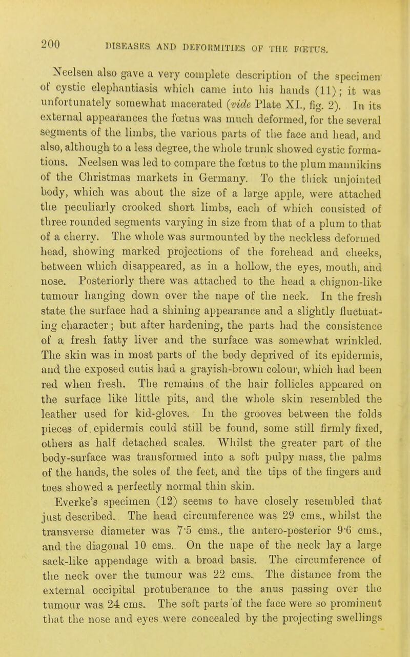 Neelsen also gave a very complete description of the specimen of cystic elephantiasis which came into his hands (11); it was unfortunately somewhat macerated (vide Plate XI., fig. 2). In its external appearances the foetus was much deformed, for the several segments of the limbs, the various parts of the face and head, and also, although to a less degree, the whole trunk showed cystic forma- tions. Neelsen was led to compare the foetus to the plum mannikins of the Christmas markets in Germany. To the thick unjointed body, which was about the size of a large apple, were attached the peculiarly crooked short limbs, each of which consisted of three rounded segments varying in size from that of a plum to that of a cherry. The whole was surmounted by the neckless deformed head, showing marked projections of the forehead and cheeks, between which disappeared, as in a hollow, the eyes, mouth, and nose. Posteriorly there was attached to the head a chignon-like tumour hanging down over the nape of the neck. In the fresh state the surface had a shining appearance and a slightly fluctuat- ing character; but after hardening, the parts had the consistence of a fresh fatty liver and the surface was somewhat wrinkled. The skin was in most parts of the body deprived of its epidermis, and the exposed cutis had a grayish-brown colour, which had been red when fresh. The remains of the hair follicles appeared on the surface like little pits, and the whole skin resembled the leather used for kid-gloves. In the grooves between the folds pieces of epidermis could still be found, some still firmly fixed, others as half detached scales. Whilst the greater part of the body-surface was transformed into a soft pulpy mass, the palms of the hands, the soles of the feet, and the tips of the fingers and toes showed a perfectly normal thin skin. Everke’s specimen (12) seems to have closely resembled that just described. The head circumference was 29 eras., whilst the transverse diameter was 7‘5 eras., the antero-posterior 9‘6 eras., and the diagonal 10 eras,. On the nape of the neck lay a large sack-like appendage with a broad basis. The circumference of the neck over the tumour was 22 eras. The distance from the external occipital protuberance to the anus passing over the tumour was 24 eras. The soft parts of the face were so prominent that the nose and eyes were concealed by the projecting swellings