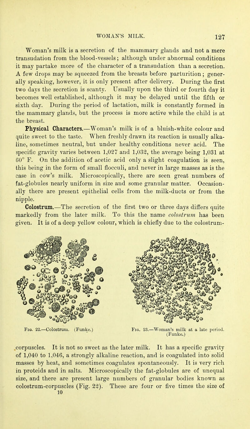 Woman's milk is a secretion of the mammary glands and not a mere transudation from the blood-vessels; although under abnormal conditions it may partake more of the character of a transudation than a secretion. A few drops may be squeezed from the breasts before parturition; gener- ally speaking, however, it is only present after delivery. During the first two days the secretion is scanty. Usually upon the third or fourth day it becomes well established, although it may be delayed until the fifth or sixth day. During the period of lactation, milk is constantly formed in the mammary glands, but the process is more active while the child is at the breast. Physical Characters.—Woman's milk is of a bluish-white colour and quite sweet to the taste. When freshly drawn its reaction is usually alka- line, sometimes neutral, but under healthy conditions never acid. The specific gravity varies between 1,027 and 1,032, the average being 1,031 at 60° F. On the addition of acetic acid only a slight coagulation is seen, this being in the form of small flocculi, and never in large masses as is the case in cow's milk. Microscopically, there are seen great numbers of fat-globules nearly uniform in size and some granular matter. Occasion- ally there are present epithelial cells from the milk-ducts or from the nipple. Colostrum.—The secretion of the first two or three days differs quite markedly from the later milk. To this the name colostrum has been given. It is of a deep yellow colour, which is chiefly due to the colostrum- FiG. 22.—Colostrum. (Funke.) Fio. 23.—Woman's milk at a late period. (Funke.) corpuscles. It is not so sweet as the later milk. It has a specific gravity of 1,040 to 1,046, a strongly alkaline reaction, and is coagulated into solid masses by heat, and sometimes coagulates spontaneously. It is very rich in proteids and in salts. Microscopically the fat-globules are of unequal size, and there are present large numbers of granular bodies known as colostrum-corpuscles (Fig. 22). These are four or five times the size of 10