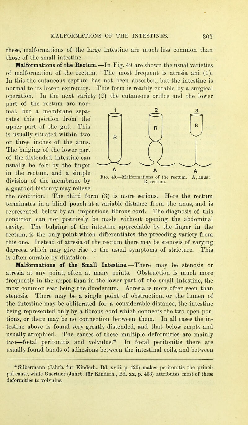 R Fig. 49.—Malformations of the rectum. A, anus ; K, rectum. these, malformations of the large intestine are much less common than those of the small intestine. Malformations of the Hectum.—In Fig. 49 are shown the usual varieties of malformation of the rectum. The most frequent is atresia ani (1). In this the cutaneous septum has not been absorbed, but the intestine is normal to its lower extremity. This form is readily curable by a surgical operation. In the next variety (2) the cutaneous orifice and the lower part of the rectum are nor- mal, but a membrane sepa- rates this portion from the upper part of the gut. This is usually situated within two or three inches of the anus. The bulging of the lower part of the distended intestine can usually be felt by the finger in the rectum, and a simple division of the membrane by a guarded bistoury may relieve the condition. The third form (3) is more serious. Here the rectum terminates in a blind pouch at a variable distance from the anus, and is represented below by an impervious fibrous cord. The diagnosis of this condition can not positively be made without opening the abdominal cavity. The bulging of the intestine appreciable by the finger in the rectum, is the only point which difl:erentiates the preceding variety from this one. Instead of atresia of the rectum there may be stenosis of varying degrees, which may give rise to the usual symptoms of stricture. This is often curable by dilatation. Malformations of the Small Intestine.—There may be stenosis or atresia at any point, often at many points. Obstruction is much more frequently in the upper than in the lower part of the small intestine, the most common seat being the duodenum. Atresia is more often seen than stenosis. There may be a single point of obstruction, or the lumen of the intestine may be obliterated for a considerable distance, the intestine being represented only by a fibrous cord which connects the two open por- tions, or there may be no connection between them. In all cases the in- testine above is found very greatly distended, and that below empty and usually atrophied. The causes of these multiple deformities are mainly two—foetal peritonitis and volvulus.* In foetal peritonitis there are usually found bands of adhesions between the intestinal coils, and between * Silbermann (Jahrb. fiir Kinderh., Bd. xviii, p. 420) makes peritonitis the princi- pal cause, while Gaertner (Jahrb. fiir Kinderh., Bd. xx, p. 403) attributes most of these deformities to volvulus.