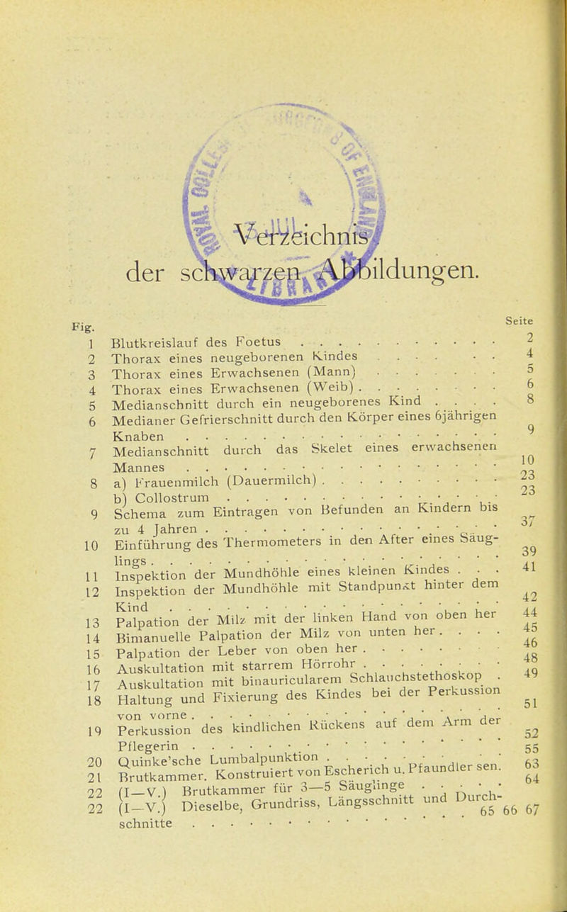 Fig. 1 2 iichnis . der sä^^z||^A^öildungen. Seite Blutkreislauf des Foetus 2 Thorax eines neugeborenen Kindes ... • . 3 Thorax eines Erwachsenen (Mann) 4 Thorax eines Erwachsenen (Weib) • ■ 5 Medianschnitt durch ein neugeborenes Kind .... 8 6 Medianer Gefrierschnitt durch den Körper eines 6jährigen Knaben • • . • ' 7 Medianschnitt durch das Skelet eines erwachsenen Mannes 8 a) Frauenmilch (Dauermilch) b) Collostrum - * ■• 9 Schema zum Eintragen von Befunden an Kindern bis zu 4 Jahren .«.*'•. 'o ■' ' 10 Einführung des Thermometers in den After eines baug- ^ lings ' .' , ' 11 Inspektion der Mundhöhle eines kleinen Kindes ... 41 12 Inspektion der Mundhöhle mit Standpunkt hinter dem ^ 13 Patoation der mW mit der linken Hand von oben her 44 14 Bimanuelle Palpation der Milz von unten her. . . . *o 15 Palpation der Leber von oben her ^ 16 Auskultation mit starrem Hörrohr . . . • • . ■ 17 Auskultation mit binauricularem Schlauchstethoskop . 49 18 Haltung und Fixierung des Kindes bei der Perkussion ^ 19 PerkussTon des kindlichen Rückens auf dem Arm der ^ Pflegerin . . . • • • • ■55 20 Quinke'sche Lumbalpunktion . ■ . • • • • g 21 Brutkammer. Konstruiert von Escherich u. Pfaundler sen. M 00 (i — v ) Brutkammer für 3—5 Säuglinge . . • ■ ■ 22 I-V.- Dieselbe, Grundriss, Längsschnitt und Durch-^