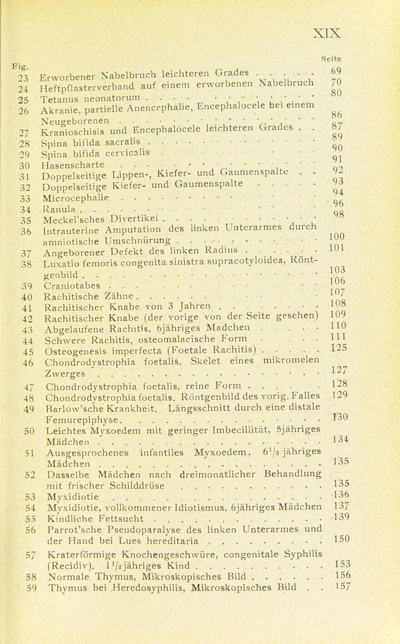 Seite F23 Erworbener Nabelbruch leichteren Grades . . . 69 24 Heftpflasterverband auf einem erworbenen Nabelbruch /0 25 Tetanus neonatorum • • - 26 Akranie, partielle Anencephalie, Encephalocele bei einem ^ Neugeborenen .... ' j' ' ' 27 Kranioschisis und Encephalocele leichteren Grades . . 87 28 Spina bifida sacralis 29 Spina bifida cervicalis . 30 Hasenscharte . . • • ■ • • ■ • • • ■ • - „ 31 Doppelseitige Uppen-, Kiefer- und Gaumenspalte . . 92 32 Doppelseitige Kiefer- und Gaumenspalte 33 Microcephalie • 34 Ranula 1 35 Meckel'sches Divertikel • • 36 Intrauterine Amputation des linken Unterarmes durch amniotische Umschnürung 'im 37 Angeborener Defekt des linken Radius IUI 38 Luxatio femoris congenita sinistra supracotyloidea, Rönt- genbild • ■ • • ■ • • 39 Craniotabes . ° 40 Rachitische Zähne ' ,rJR 41 Rachitischer Knabe von 3 Jahren C , no 42 Rachitischer Knabe (der vorige von der Seite gesehen) 109 43 Abgelaufene Rachitis, 6jähriges Madchen . . . . ■ HO 44 Schwere Rachitis, osteomalacische Form 111 45 Osteogenesis imperfecta (Foetale Rachitis) 125 46 Chondrodystrophia foetalis, Skelet eines mikromelen Zwerges 127 47 Chondrodystrophia foetalis, reine Form .... .128 48 Chondrodvstrophia foetalis. Röntgenbild des vorig. Falles 129 49 Barlow'sche Krankheit. Längsschnitt durch eine distale Femurepiphyse 130 50 Leichtes Myxoedem mit geringer Imbecillität, 5jähriges Mädchen 134 51 Ausgesprochenes infantiles Myxoedem, 6^2 jähriges Mädchen 135 52 Dasselbe Mädchen nach dreimonatlicher Behandlung mit frischer Schilddrüse . 135 53 Myxidiotie .136 54 Myxidiotie, vollkommener Idiotismus, ojähriges Mädchen 137 55 Kindliche Fettsucht 139 56 Parrot'sche Pseudoparalyse des linken Unterarmes und der Hand bei Lues hereditaria 150 57 Kraterförmige Knochengeschwüre, congenitale Syphilis (Recidiv). P/2 jähriges Kind 153 58 Normale Thymus, Mikroskopisches Bild 156 59 Thymus bei Heredosyphilis, Mikroskopisches Bild . . 157