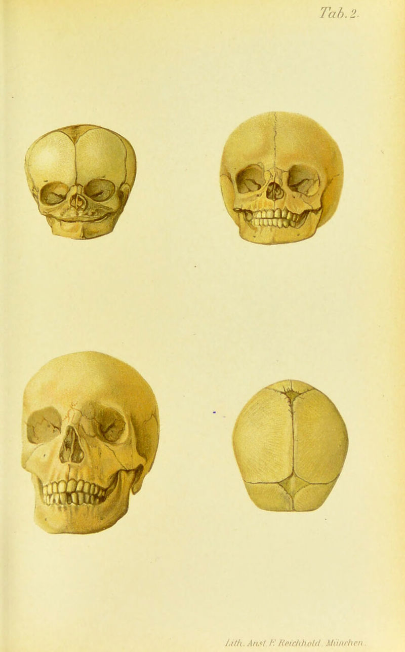 LWt.AnSt /■: Rpic/tlwld A/ii/ir/icn