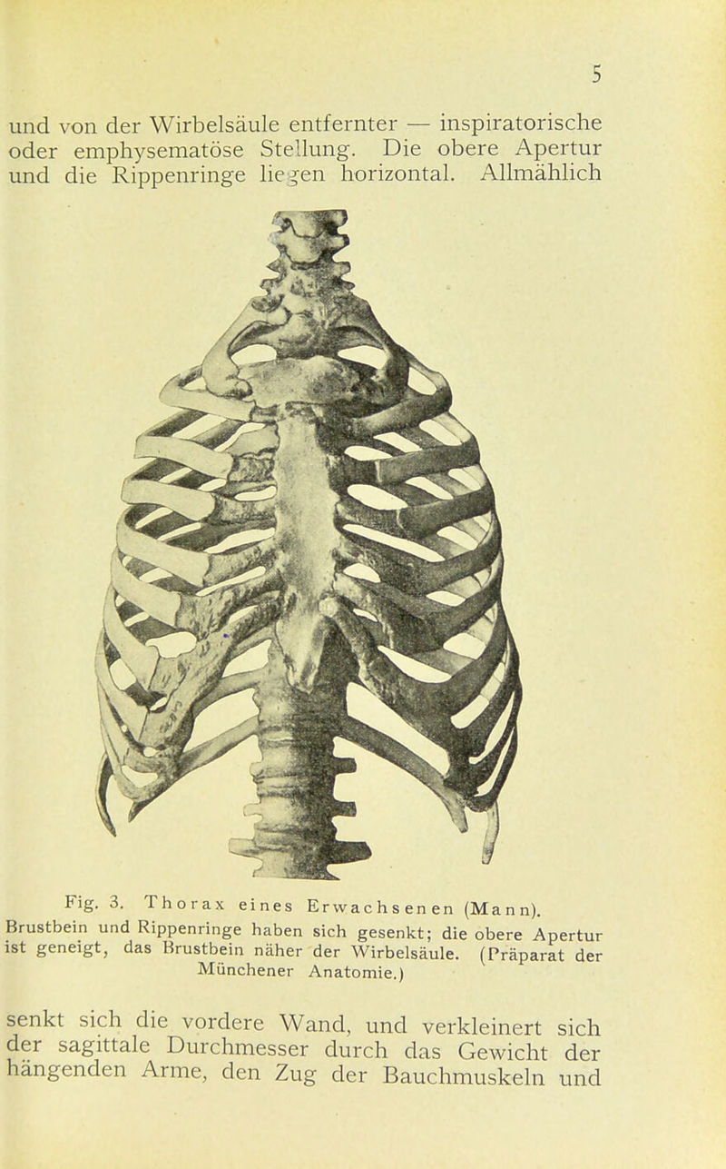 und von der Wirbelsäule entfernter — inspiratorische oder emphysematöse Stellung. Die obere Apertur und die Rippenringe liegen horizontal. Allmählich Fig. 3. Thorax eines Erwachsenen (Mann). Brustbein und Rippenringe haben sich gesenkt; die obere Apertur ist geneigt, das Brustbein näher der Wirbelsäule. (Präparat der Münchener Anatomie.) senkt sich die vordere Wand, und verkleinert sich der sagittale Durchmesser durch das Gewicht der hangenden Arme, den Zug der Bauchmuskeln und